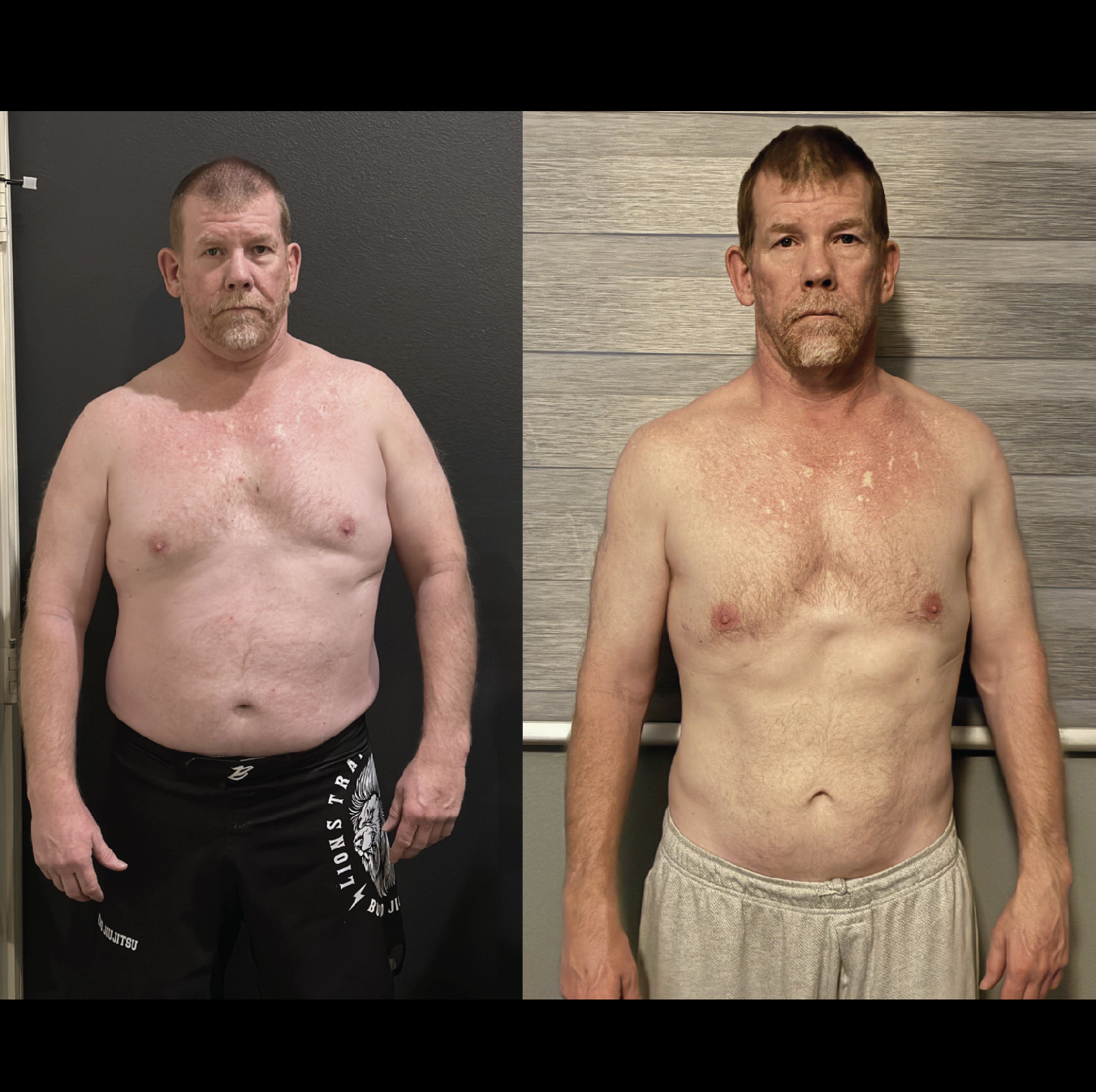Side-by-side before and after photos of a shirtless middle-aged man showing weight loss and skin changes.