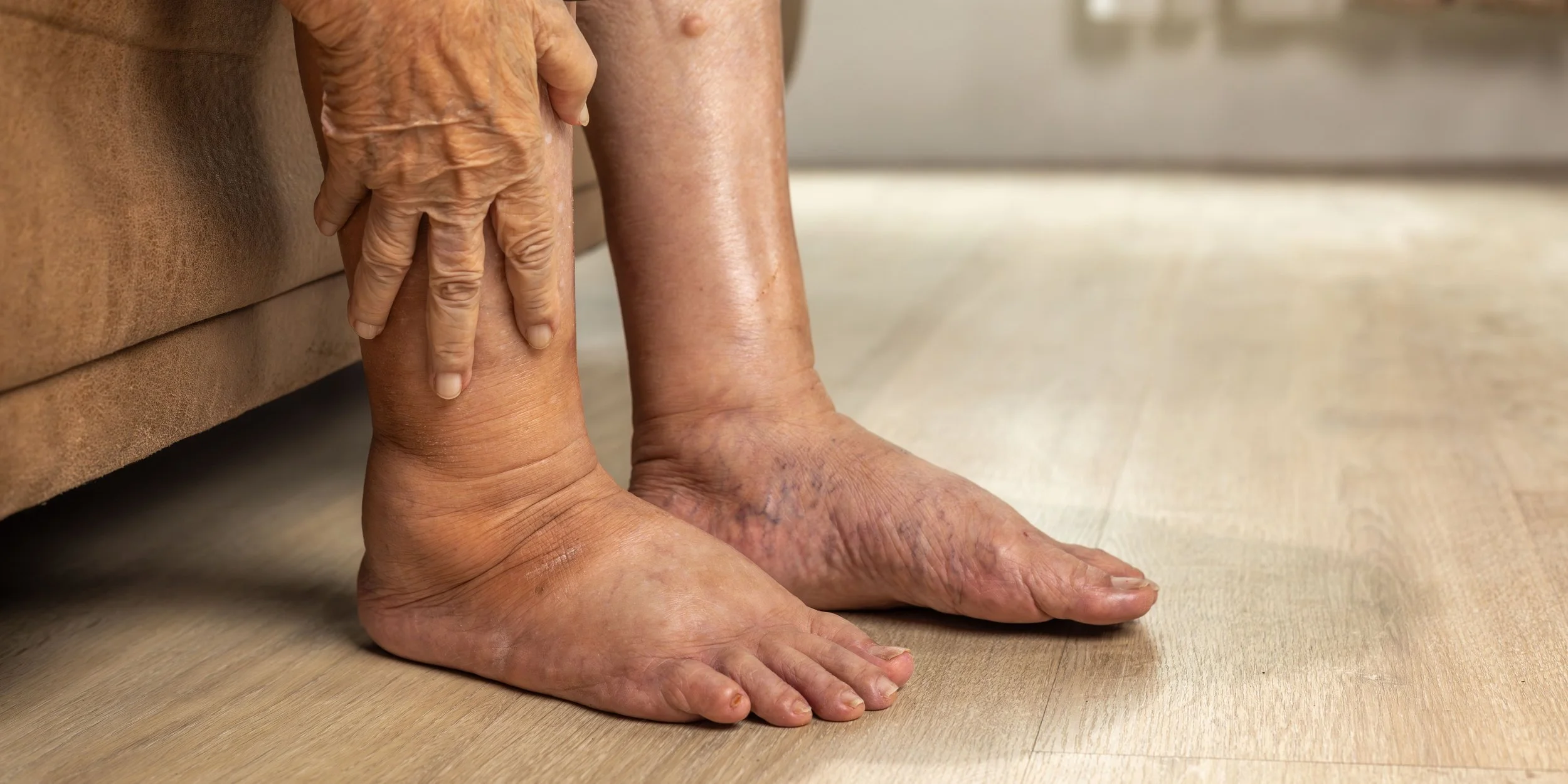Diabetes and Your Feet: Hidden Changes You Might Not Notice