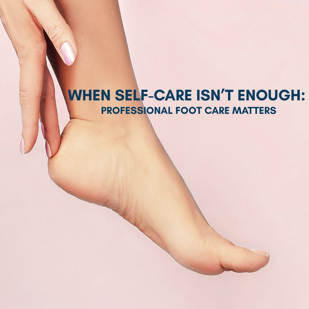 When Self-Care Isn’t Enough: Professional Foot Care Matters