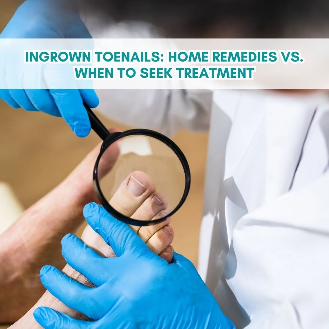 Ingrown Toenails: Home Remedies vs. When to Seek Treatment