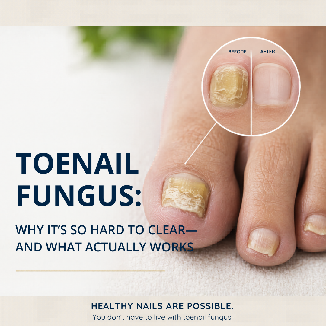 Why Toenail Fungus Won’t Go Away — and What Works