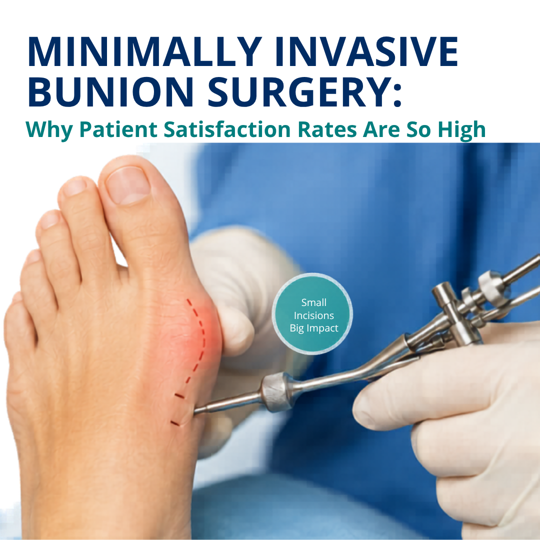 Minimally Invasive Bunion Surgery: Why Patient Satisfaction Rates Are So High