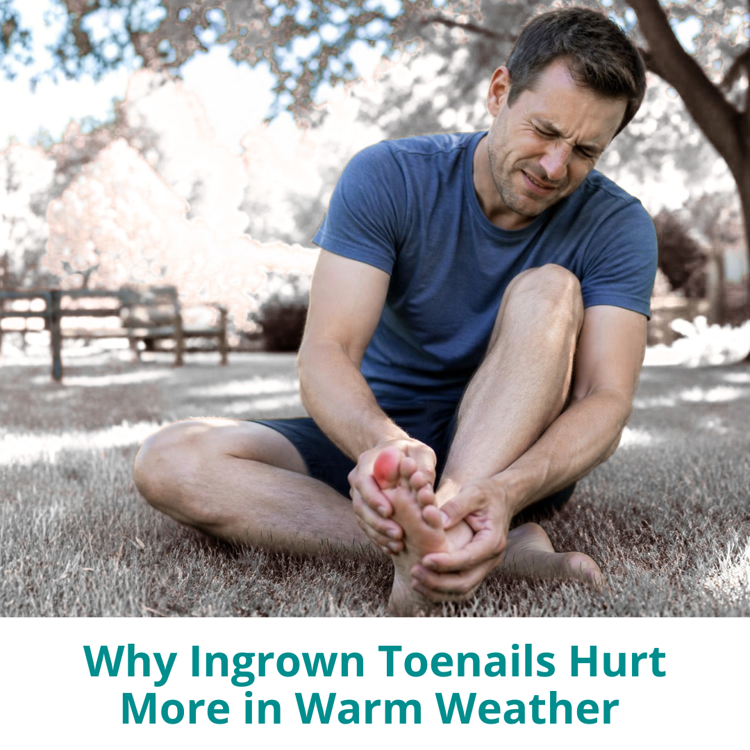 Why Ingrown Toenails Hurt More in Warm Weather