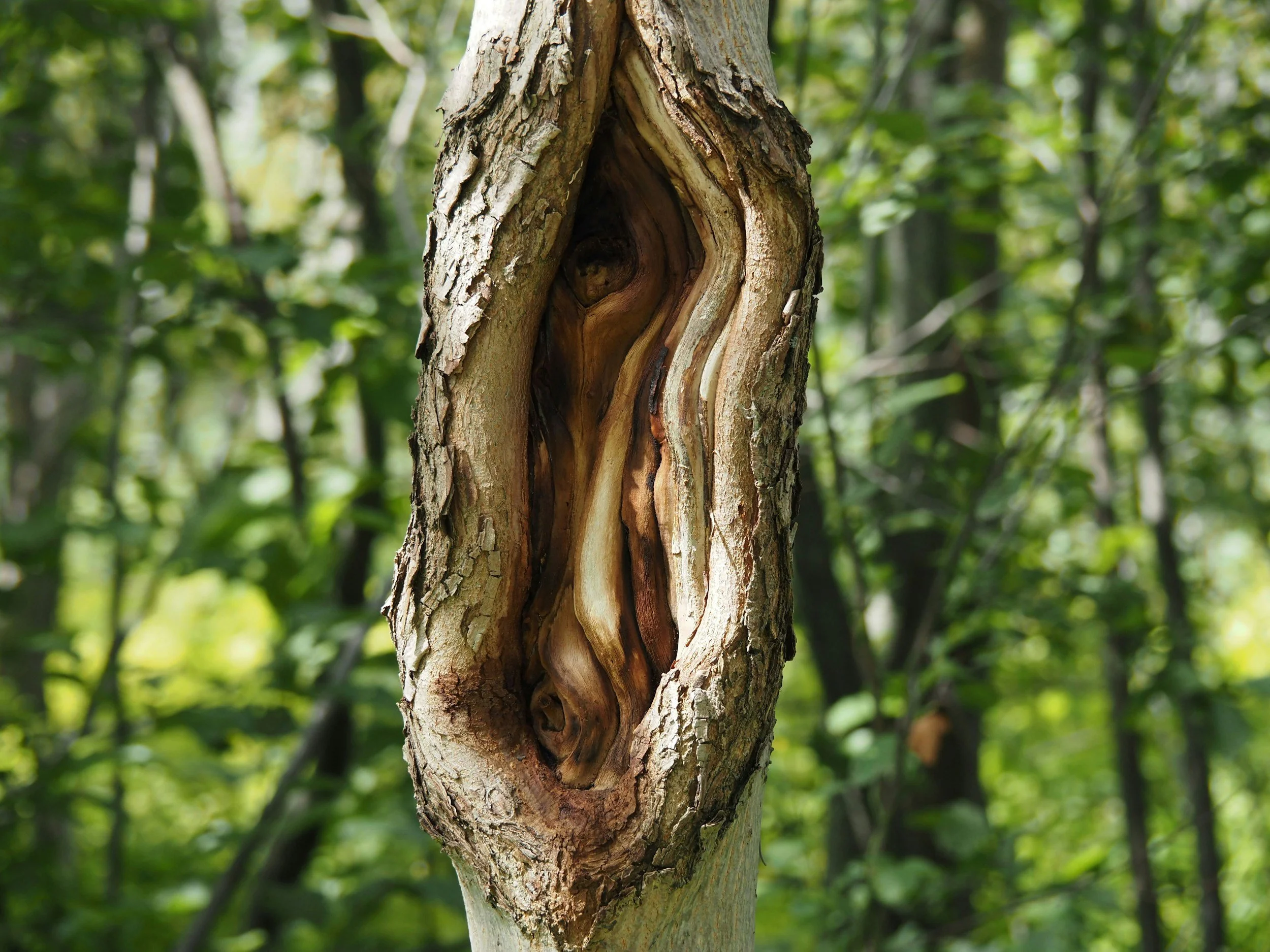 Sexual Health After Cancer: What Every Survivor Should Know About Vaginal Estrogen