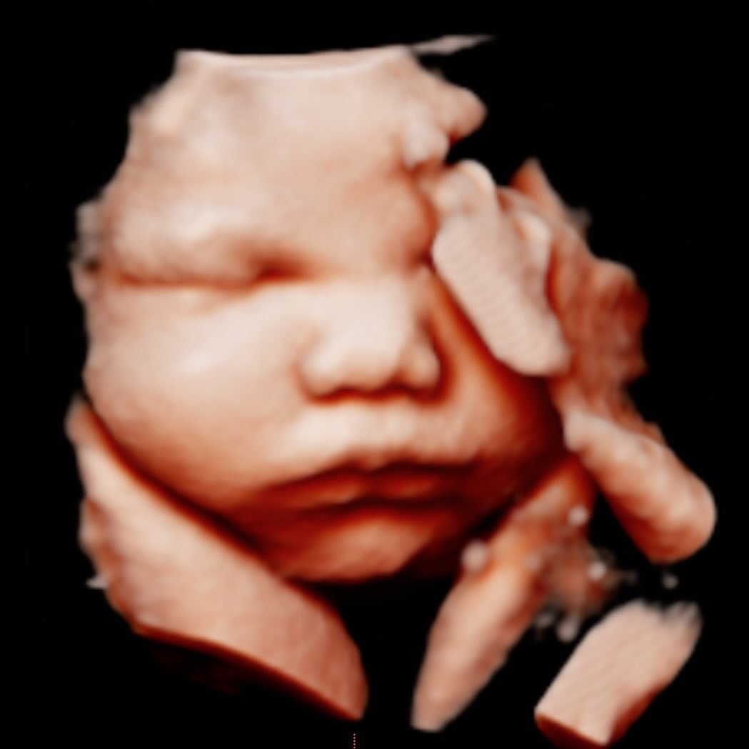 Had the absolute honor of capturing these 4D images of this tiny love due this spring. 
These elective, non-medical ultrasounds are *FREE* for people with Partnership/Medi-Cal clients and are included with visits where requested for private pay clien