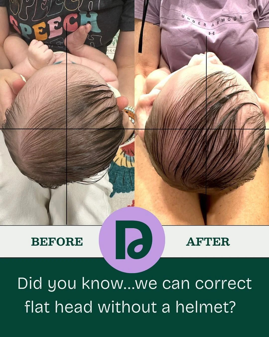 Want to learn more about how pediatric physical therapy can help your baby? Send us a DM! We&rsquo;d love to chat!