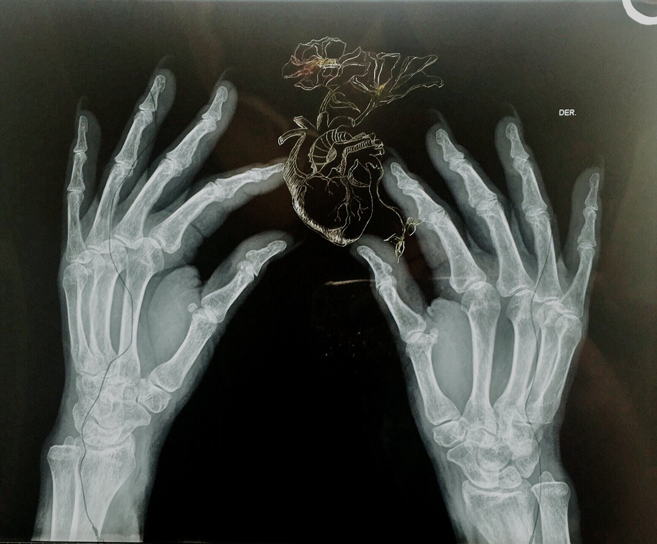 My Heart is in Your Hands - Scratched drawing and oil on x-ray
12 x 14 inches