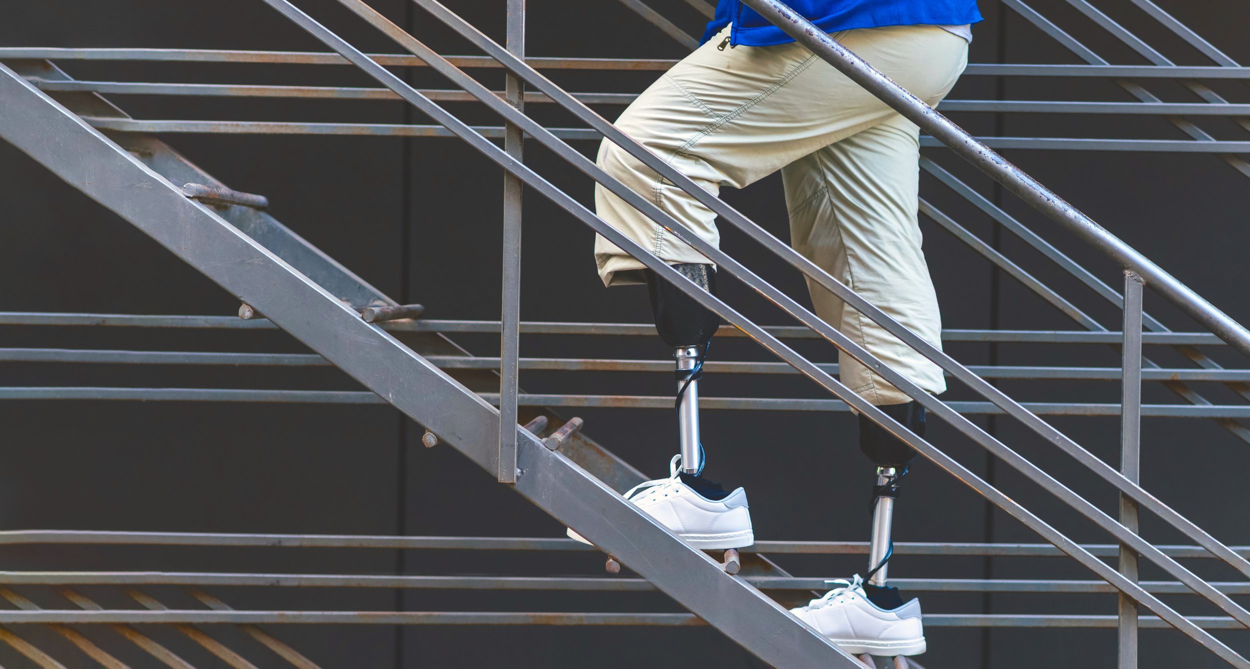 Custom Prosthetics in Calgary Certified Prosthetics Prosthesis