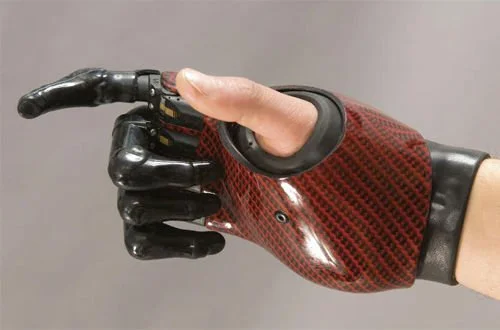 Custom Prosthetics in Calgary | Certified Prosthetics | Prosthesis ...