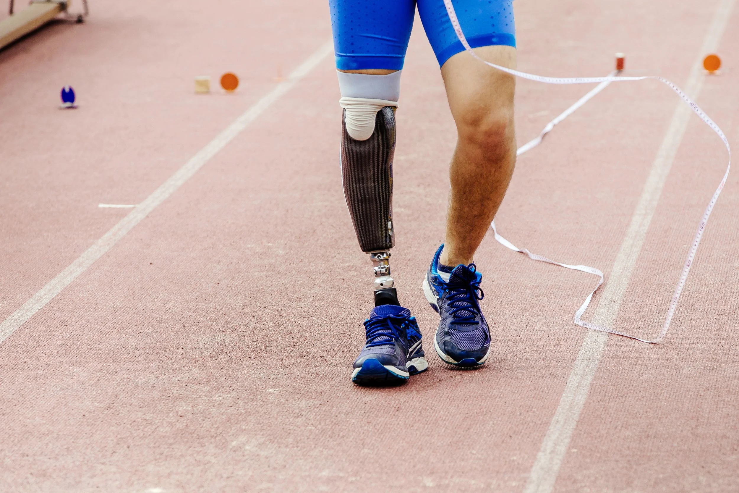 Custom Orthotics & Prosthetics Services in Calgary, AB — ALIGN ...