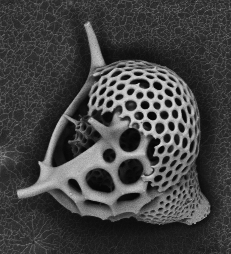 SCANNING ELECTRON MICROSCOPY
