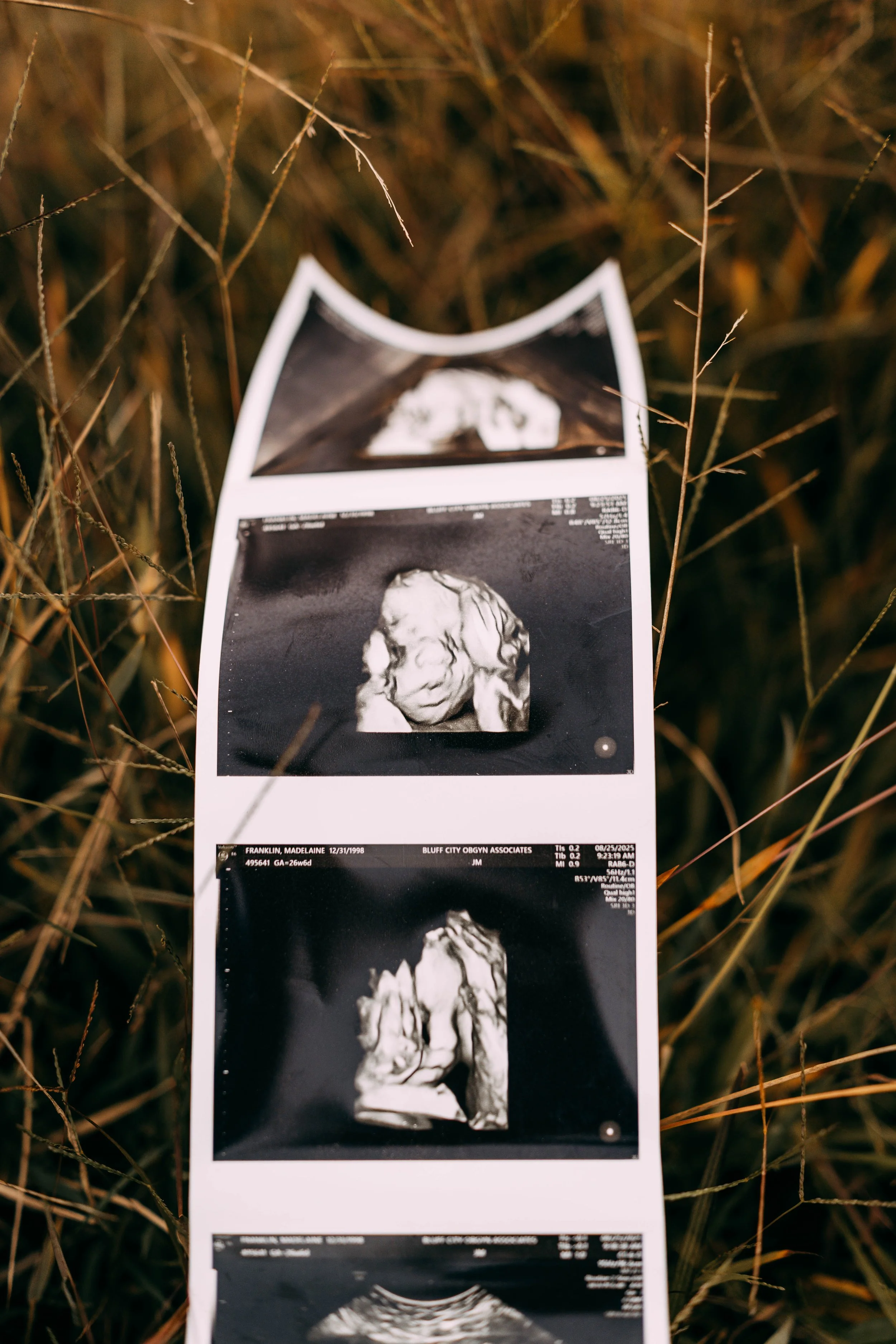 A strip of ultrasound images showing a developing fetus, laid on tall grass with a blurred natural background.