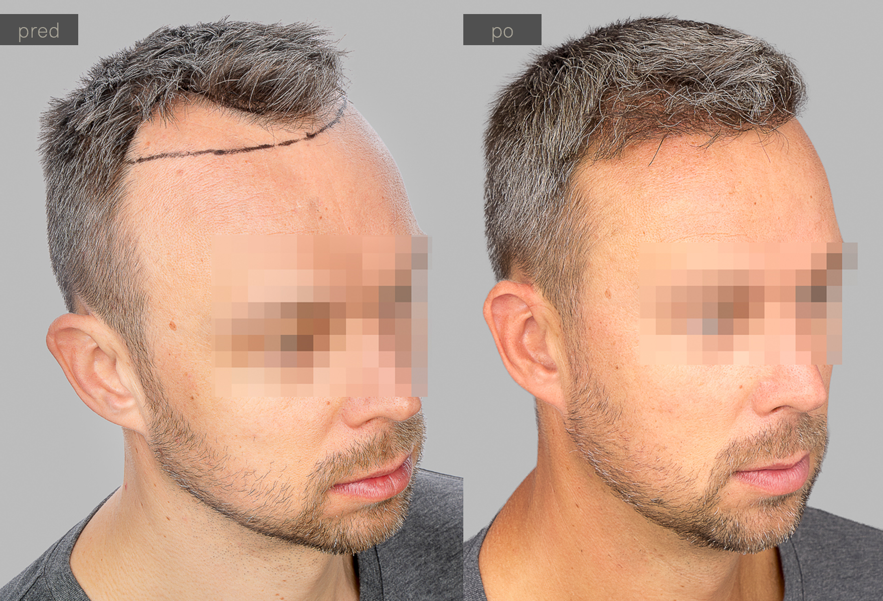 Mato web%pred a po.png