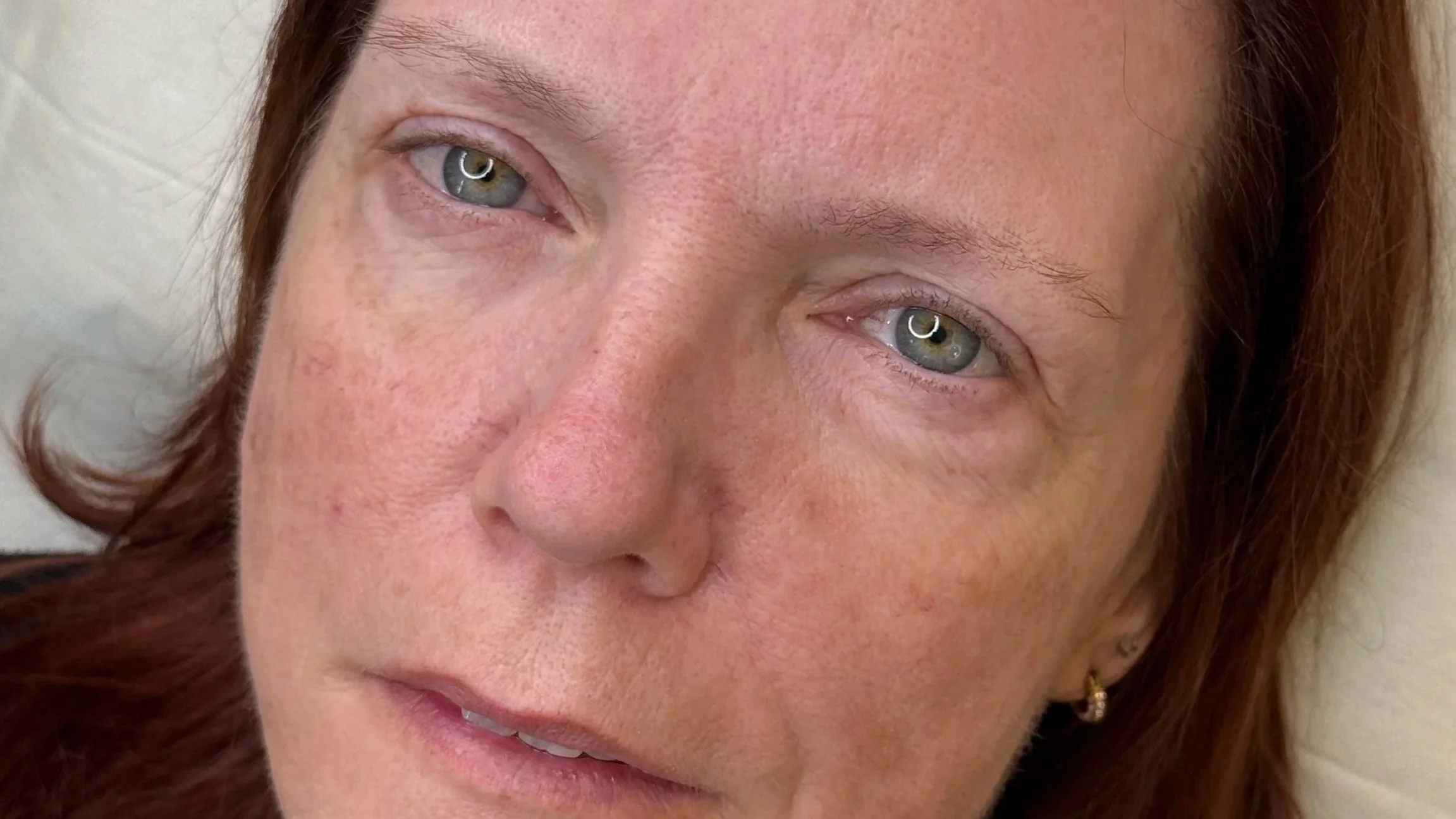 redheaded woman with blue eye before permanent makeup with sparse brows