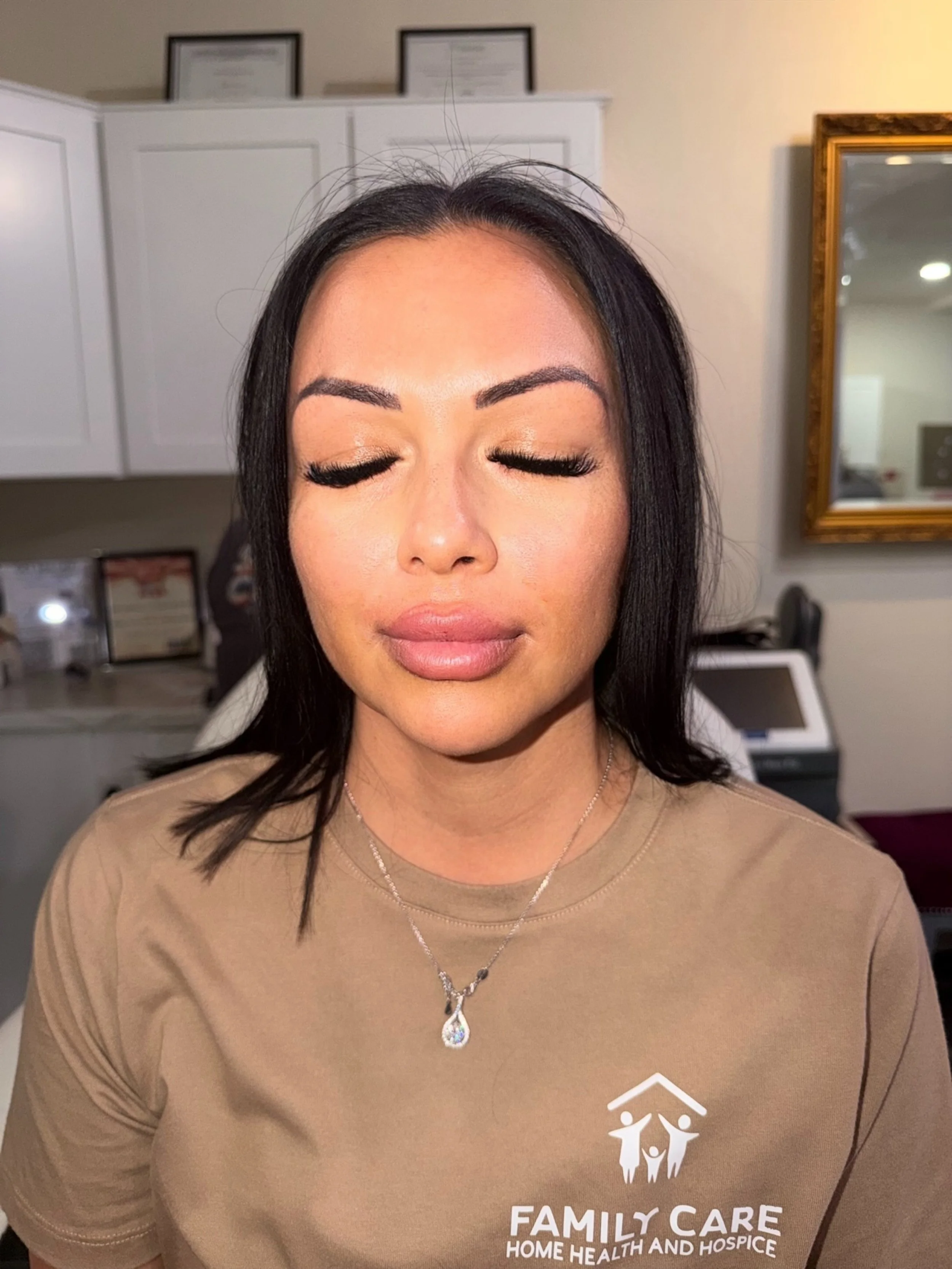 The Secret to a Perfect Pout: Why "Balance" is Everything in Lip Fillers