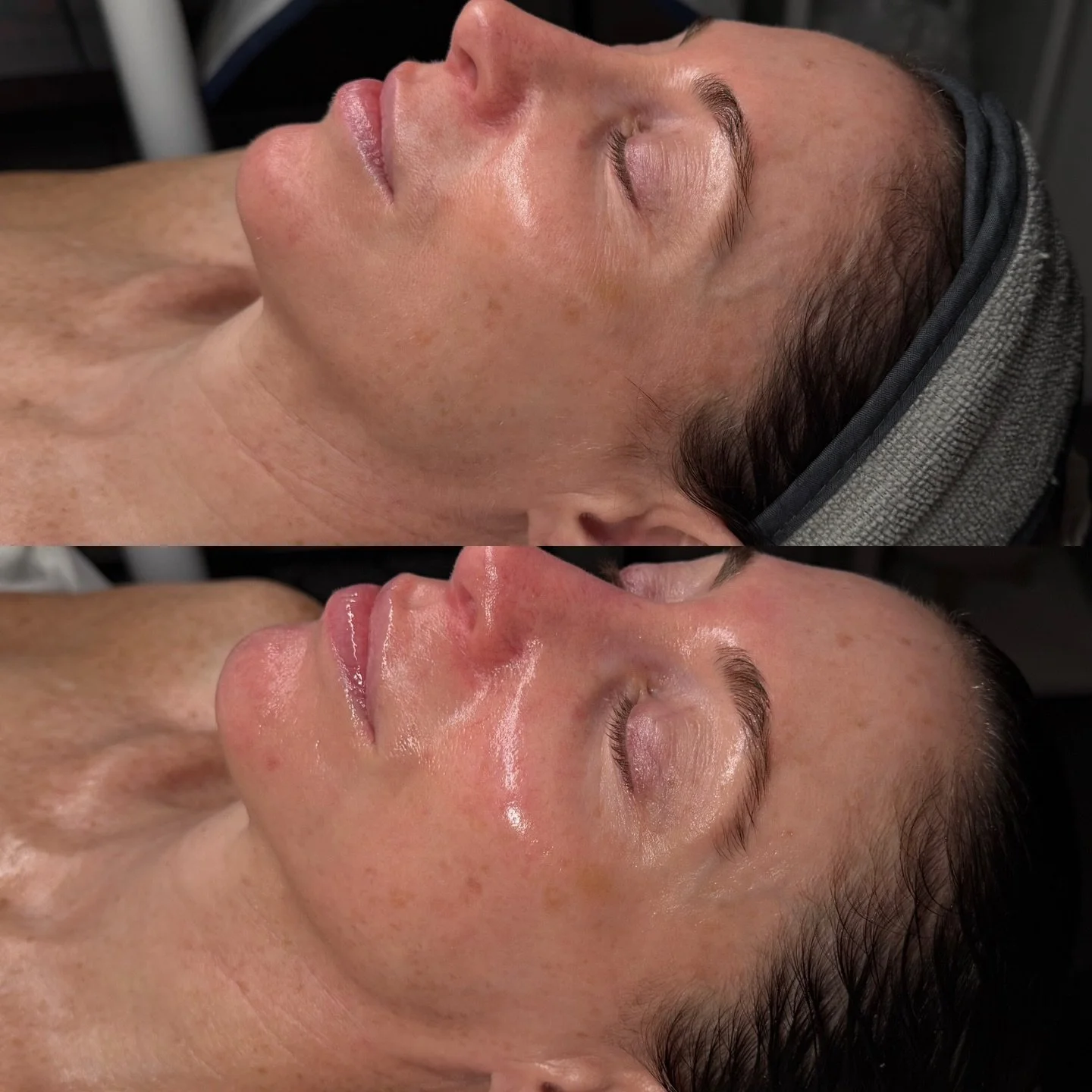 Gorgeous &amp; Glowing 😍😍
Another snatched before and after &amp; look at that eye area 🤯
This is immediately after a 90 min Customized Facial including;
✔️Dermaplaning
✔️Environ Cool Peel 
✔️Face Sculpting Massage 
✔️Microcurrent Infusion
✔️LED
E