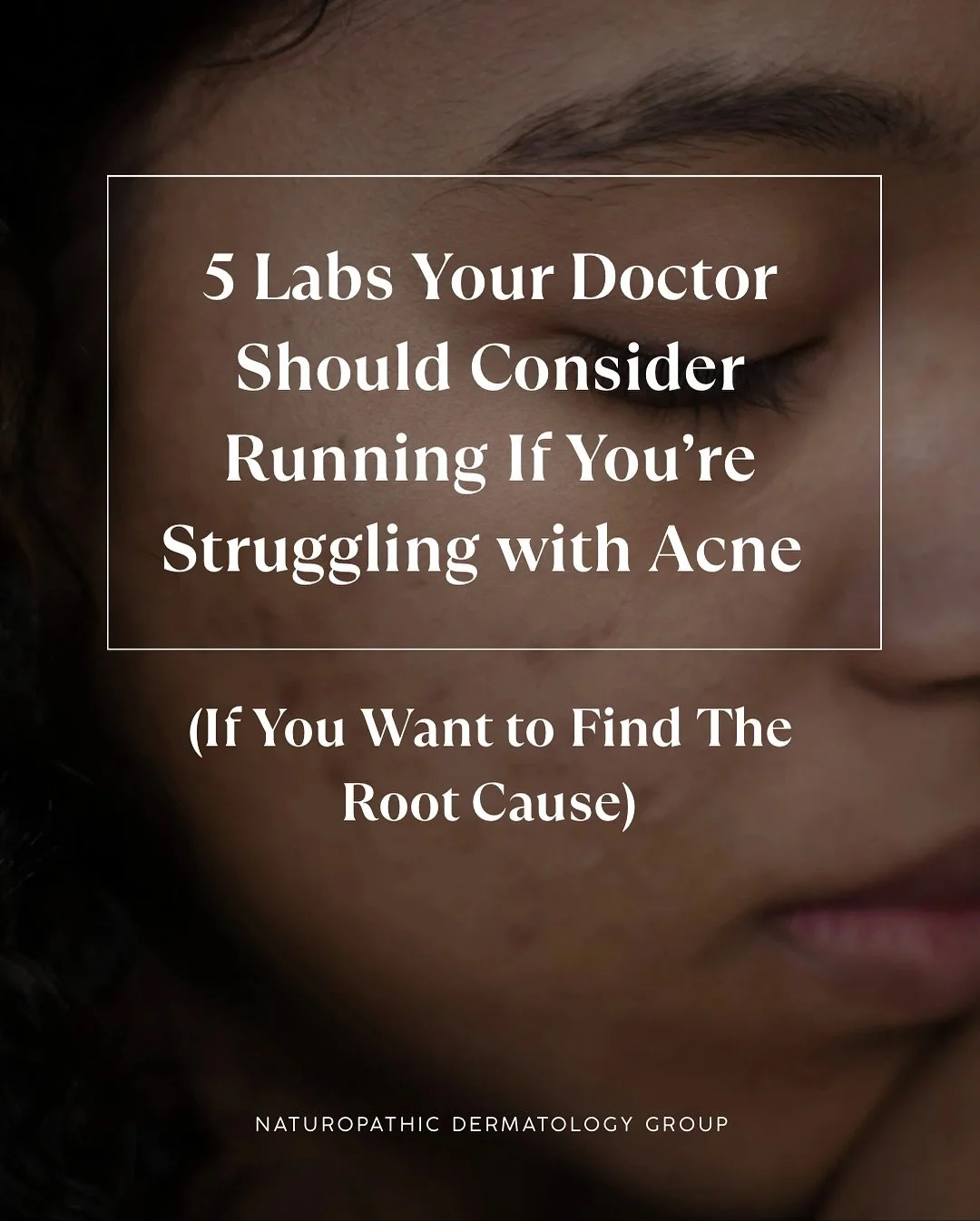 Most people never get this kind of testing when they go to their doctor to discuss acne&hellip;but if you want to truly heal acne from the inside out, labs matter!

Here are the tests I commonly recommend for my acne patients:
- Comprehensive Gut Tes