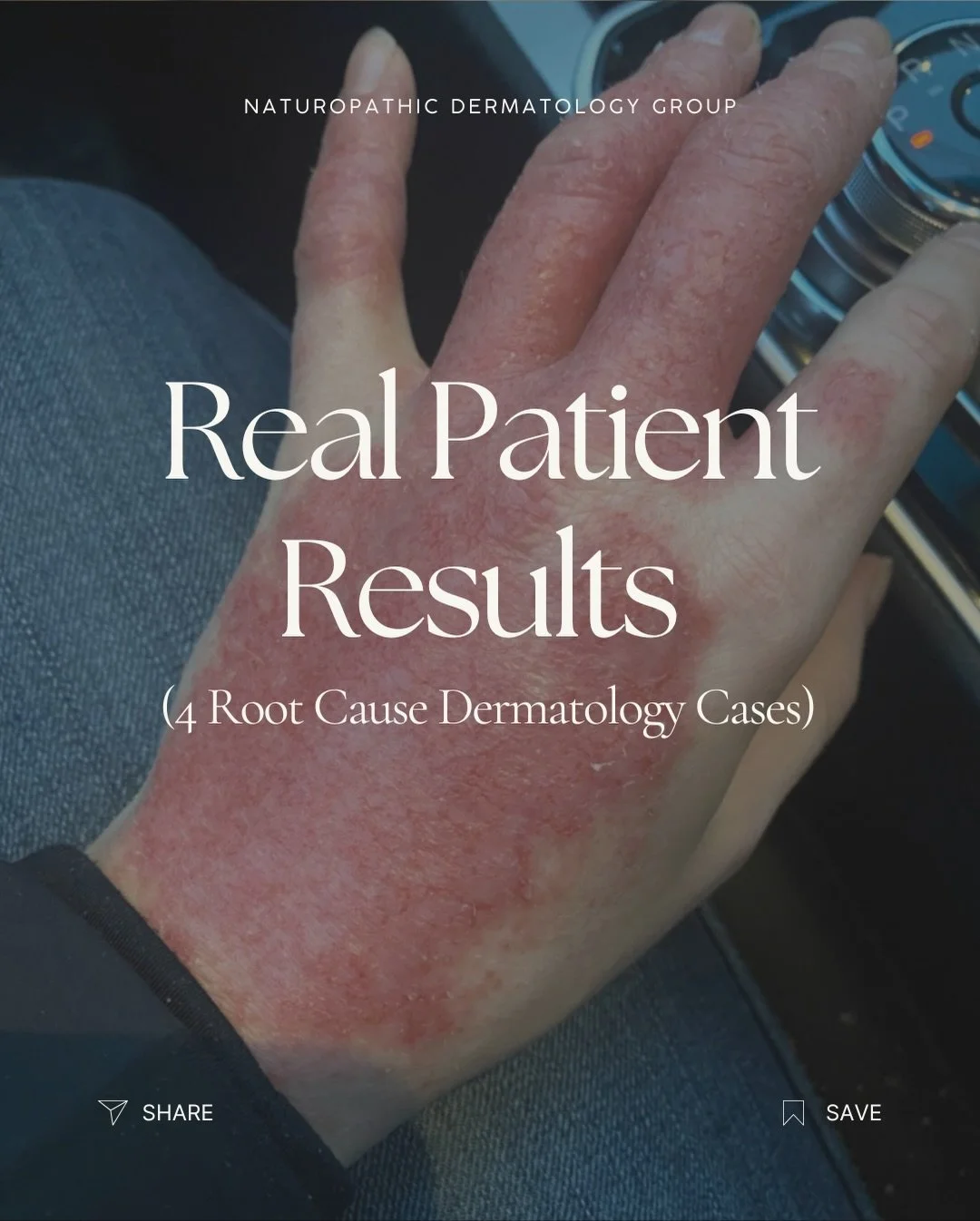 Skin symptoms are one of the ways your body communicates something is wrong internally. It&rsquo;s important to listen!

These are 4 real patient cases where treating the deeper root causes is what finally led to lasting results. Once we looked inter
