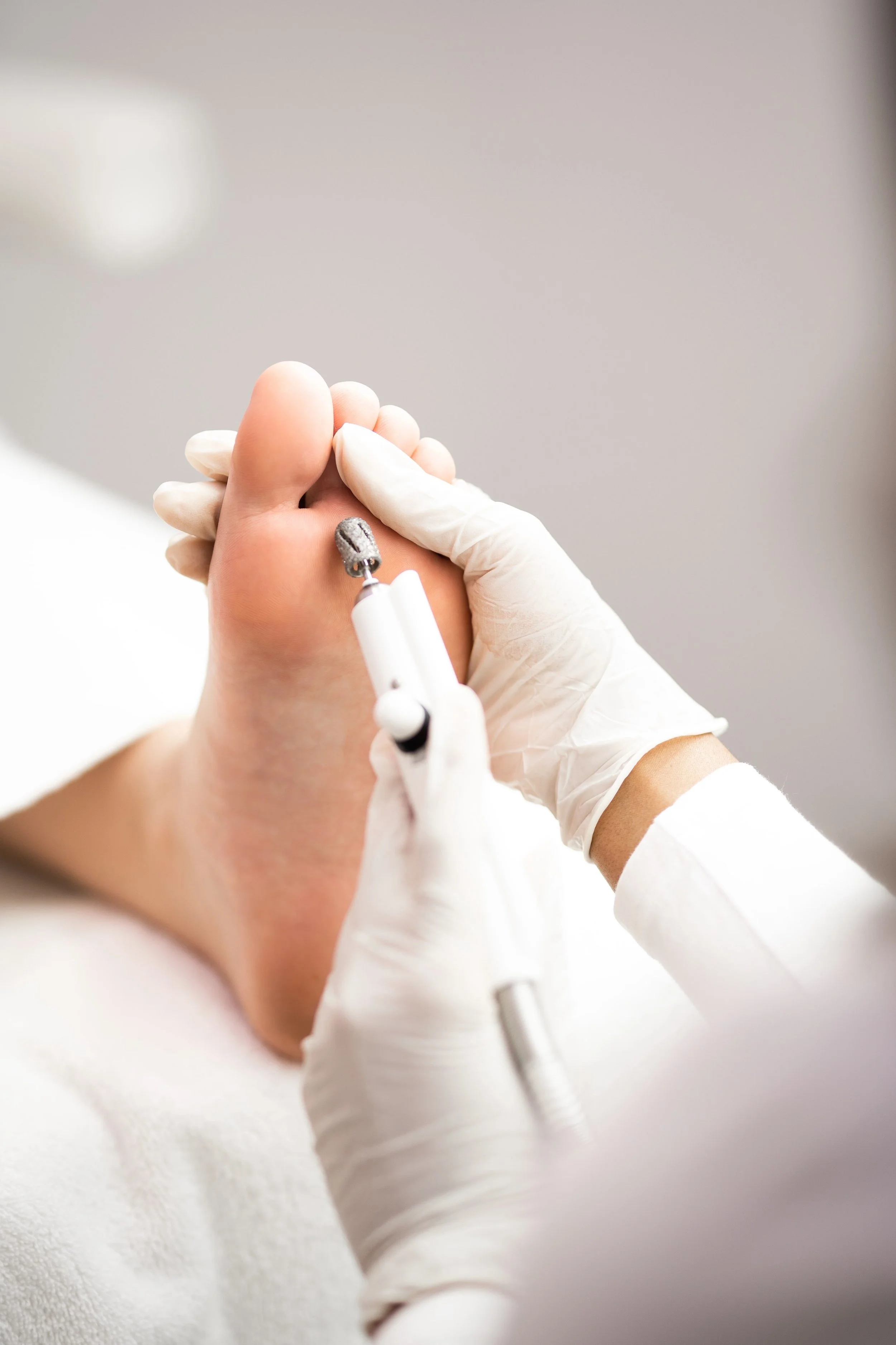 Nahaufnahme einer medizinischen Fußpflegebehandlung mit Handschuhen und elektrischem Fräser am großen Zeh