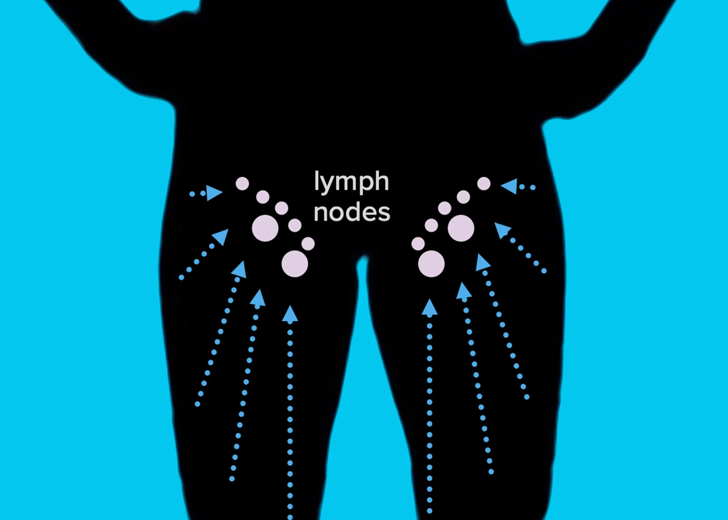 Diagram showing lymph nodes in the lower torso area, with arrows indicating lymph flow.