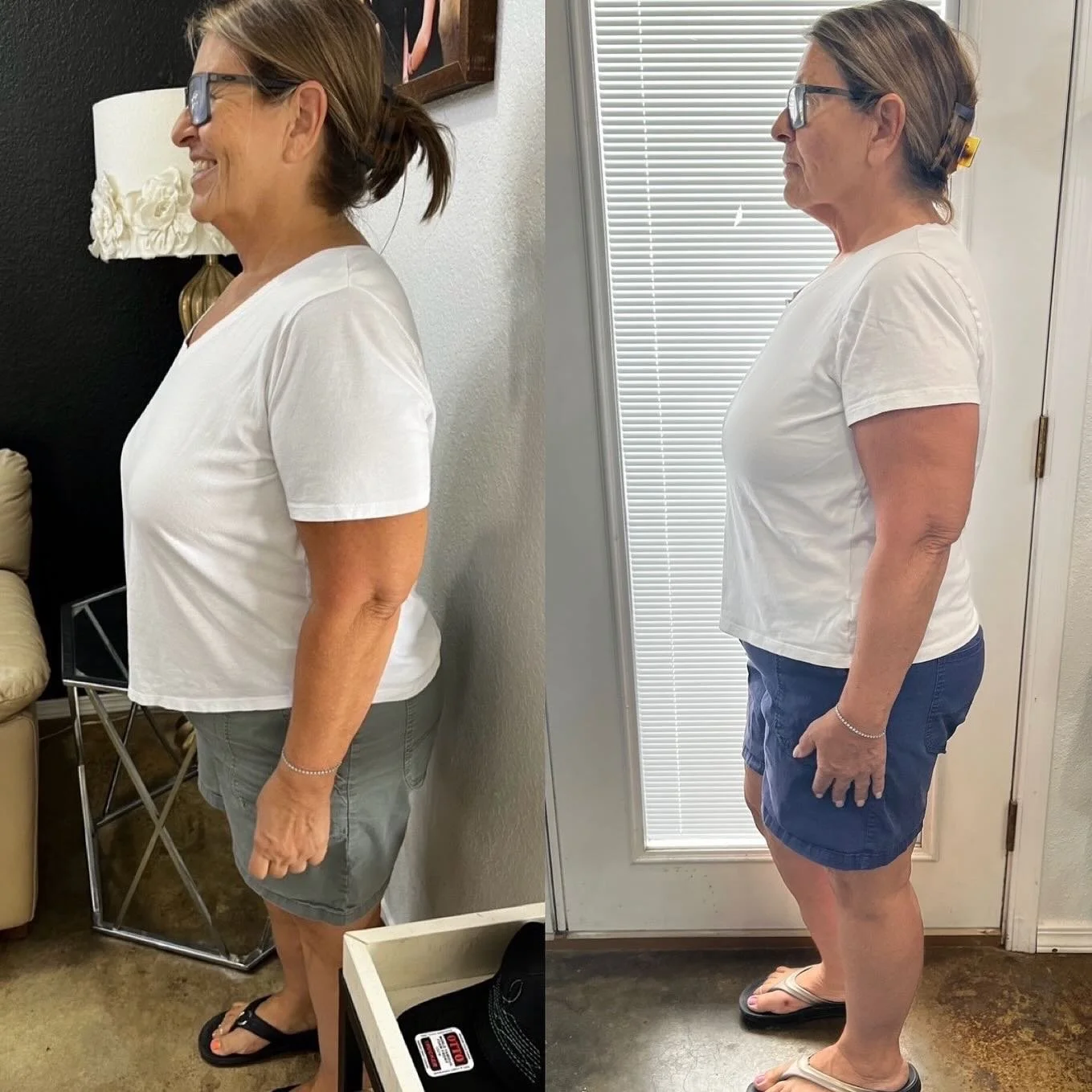 💉 Understanding GLP-1 Therapy: Semaglutide &amp; Tirzepatide 💉

GLP-1 receptor agonists (like Semaglutide) and dual GLP-1/GIP receptor agonists (like Tirzepatide) are evidence-based metabolic therapies designed to support weight management and impr