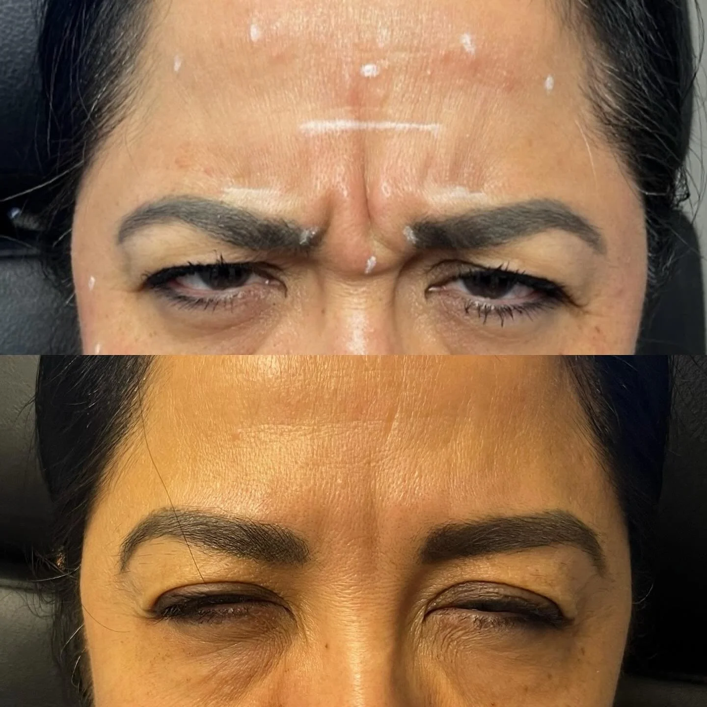 ✨ The holiday season is around the corner &mdash; and that means it&rsquo;s time to start your glow prep. ✨

Botox takes about 7&ndash;14 days to fully settle, so now is the perfect time to plan ahead for smooth, refreshed skin just in time for every