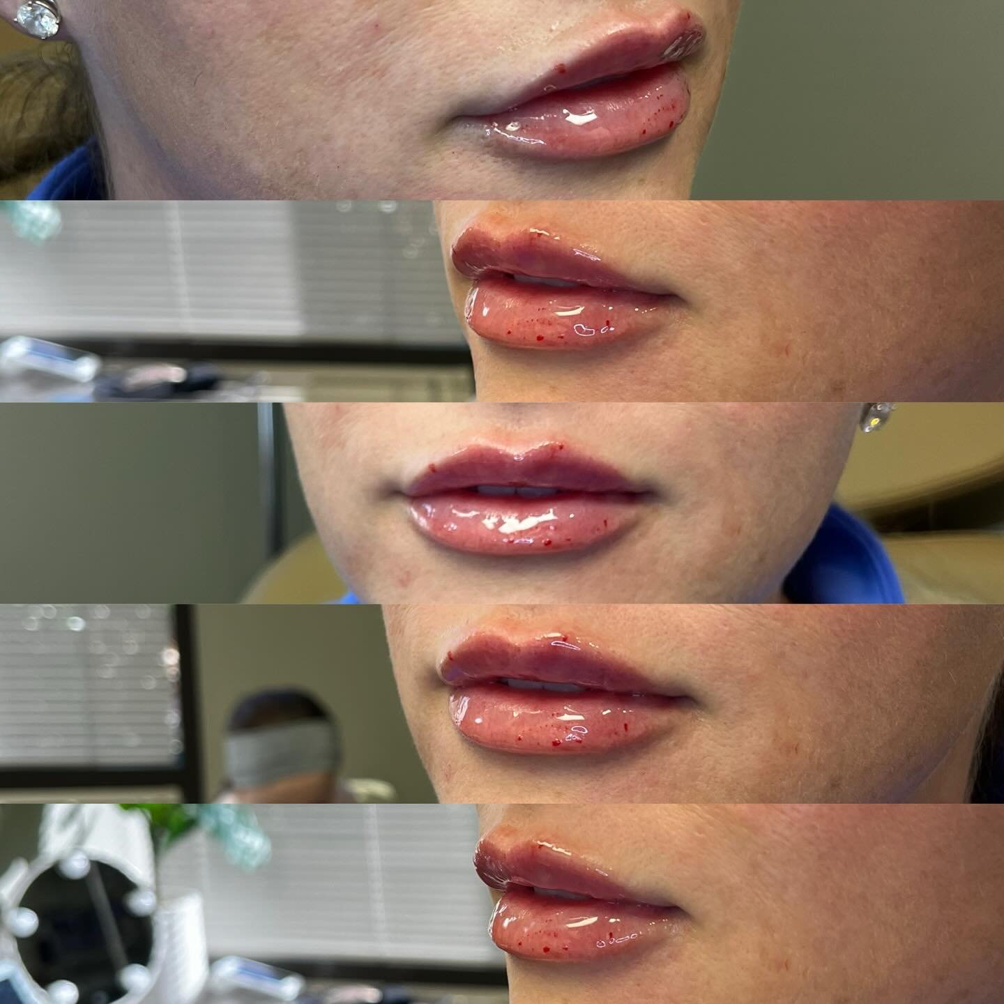 💋✨ Holiday lips loading&hellip;
If Santa isn&rsquo;t bringing you a new pout this year&hellip; don&rsquo;t worry babe, I will. 😉

&lsquo;Tis the season for sharper borders, plush pillows, and lips that give &ldquo;I&rsquo;m the gift.&rdquo; You des