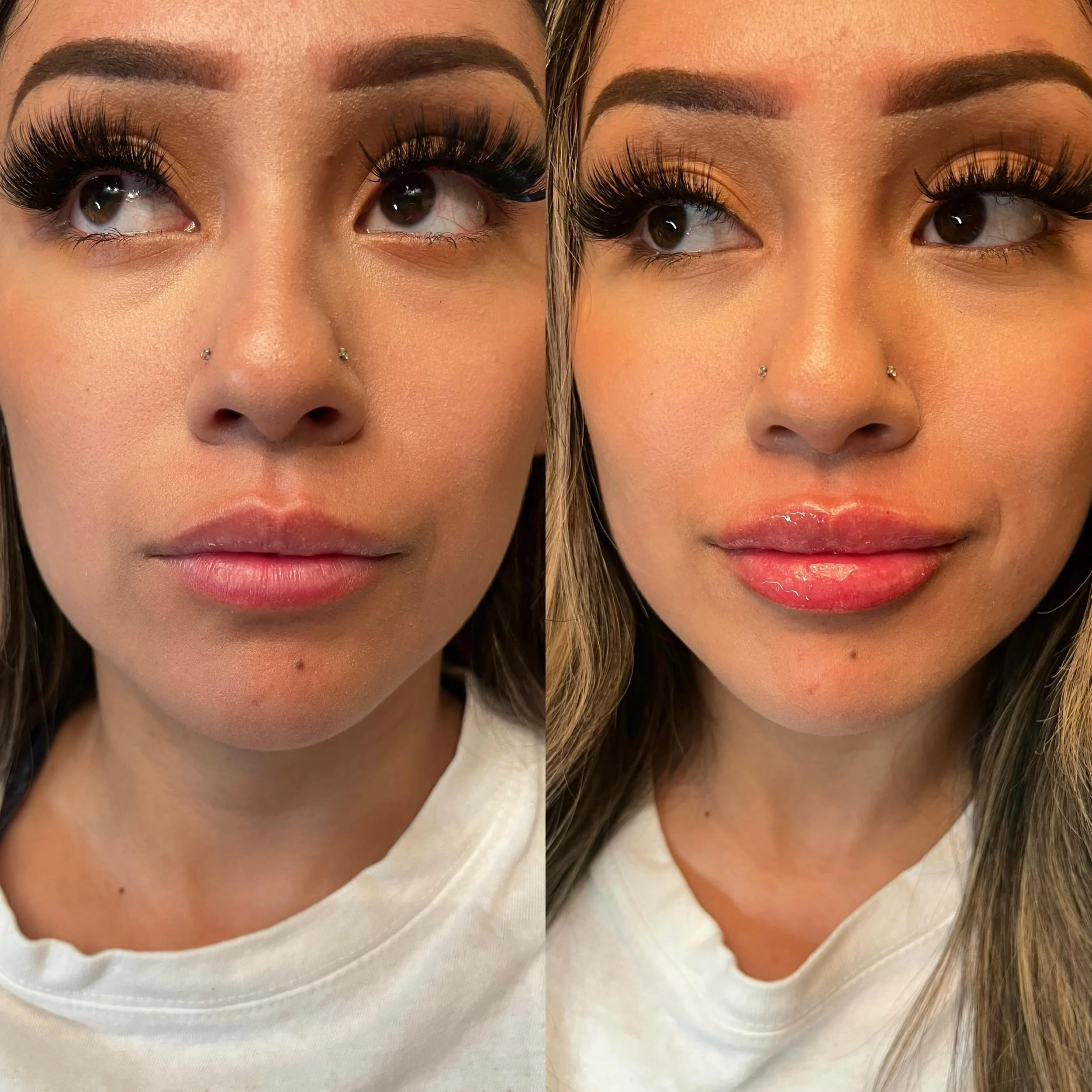 Been waiting to post these lips 💋✨

Revaneese lips stole the show once again. Soft, hydrated, balanced, and beautifully refined. One of my favorite things about Revaneese filler is the smooth integration, soft feel, and longevity while still keeping
