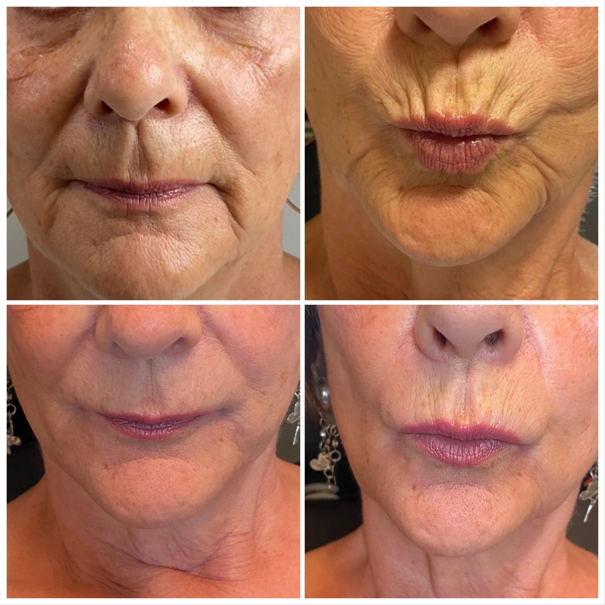 306D0FC5-8B84-4C4C-BAEC-A90F95C53B44 (1).JPEG