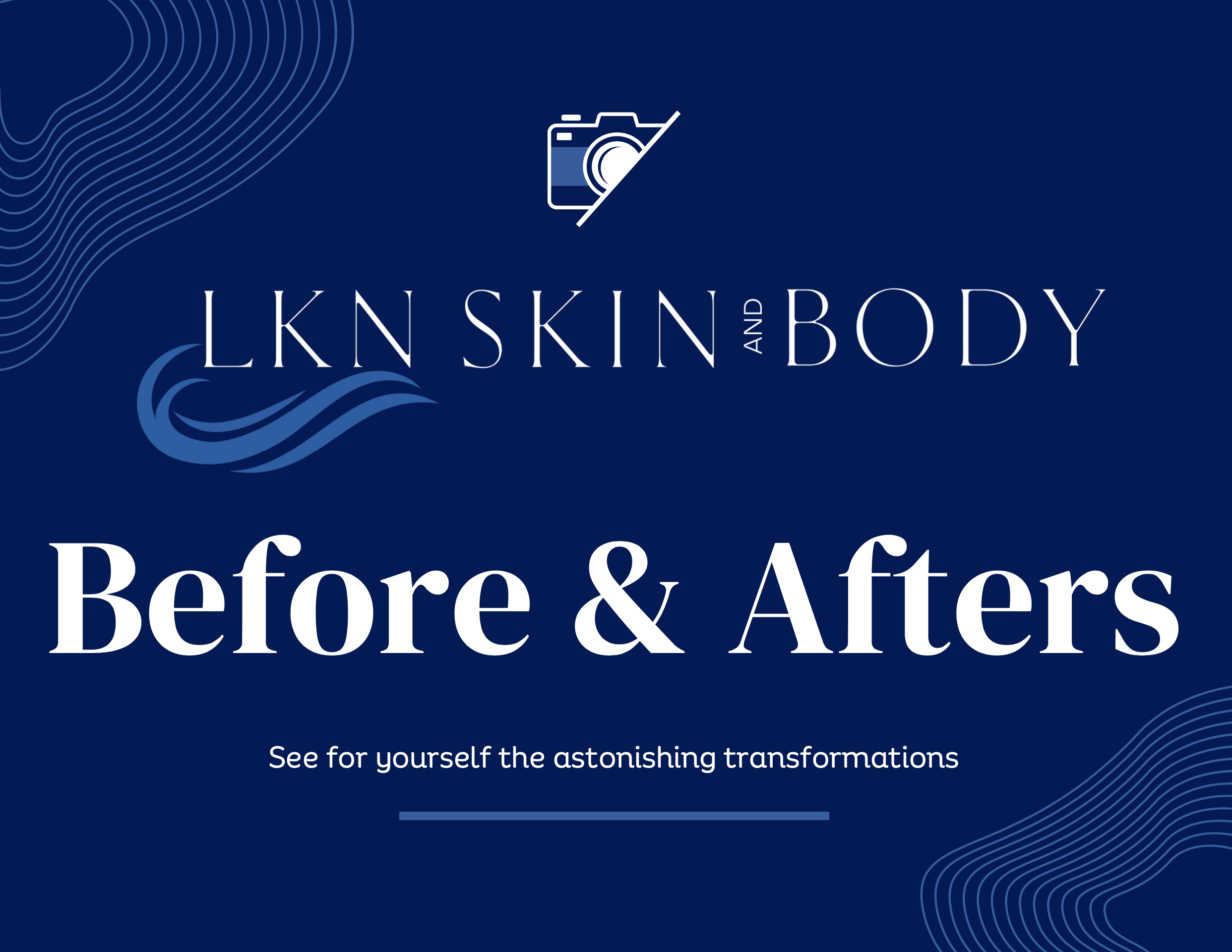 Sophie Rain Bbl: The Ultimate Before & After Transformation - o0d55uj