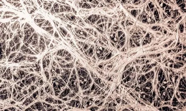 The wonders of Fascia — Waiuku Craniosacral