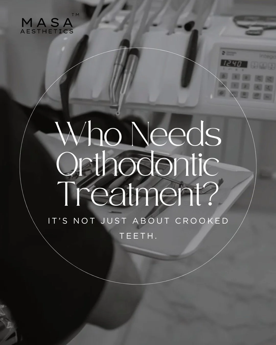Orthodontic care goes beyond straight teeth.
It&rsquo;s about balance, function, and long-term oral health.
If any of these signs feel familiar, an evaluation can help guide the right treatment ✨
📍 Expert orthodontic care at Masa Aesthetics
DM us to