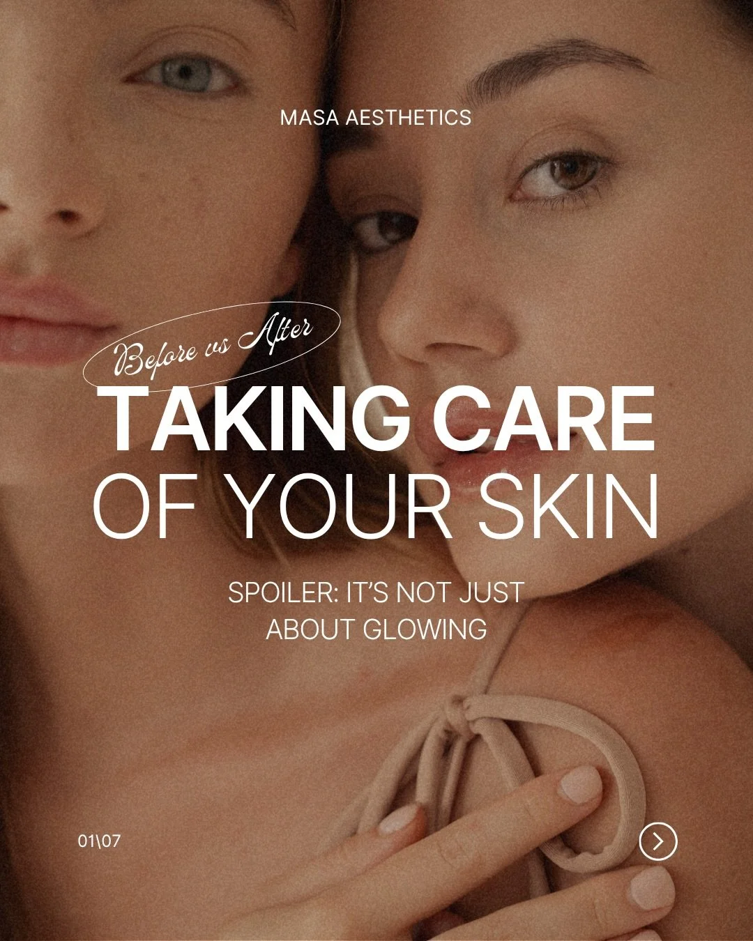 Taking care of your skin now is what builds the foundation for a healthy, long-lasting glow later. The little things you do today always show up tomorrow ✨

#skincare #healthyskin #glowingskin #skinhealth #antiaging 

(skincaretips selfcare beautyrou