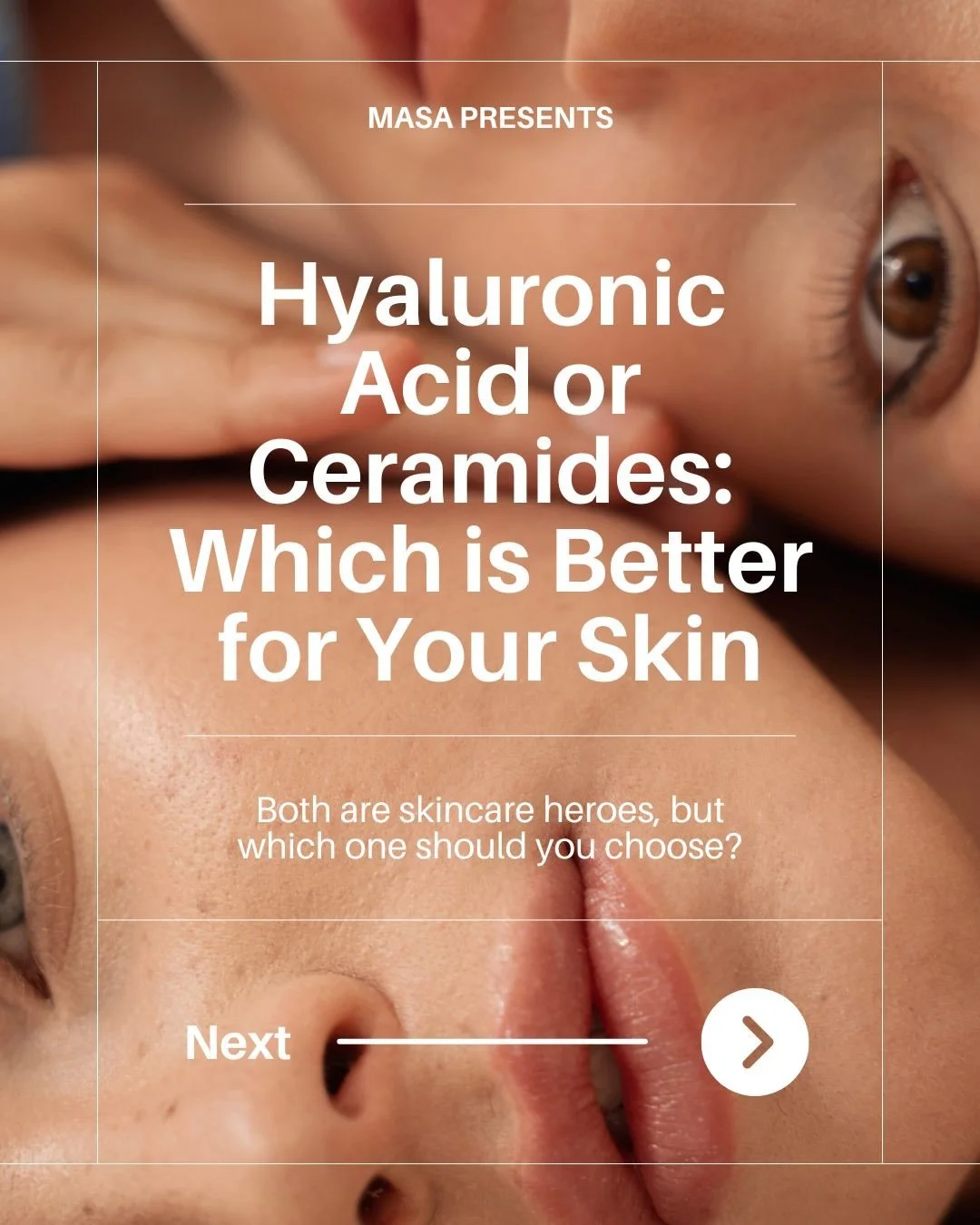 Everyone talks about hydration.
But your skin might actually be asking for repair.

Hyaluronic Acid = pulls water into the skin 💧
Ceramides = lock it in + strengthen your skin barrier 🫧

One gives the glow.
The other makes it last.

Healthy skin is