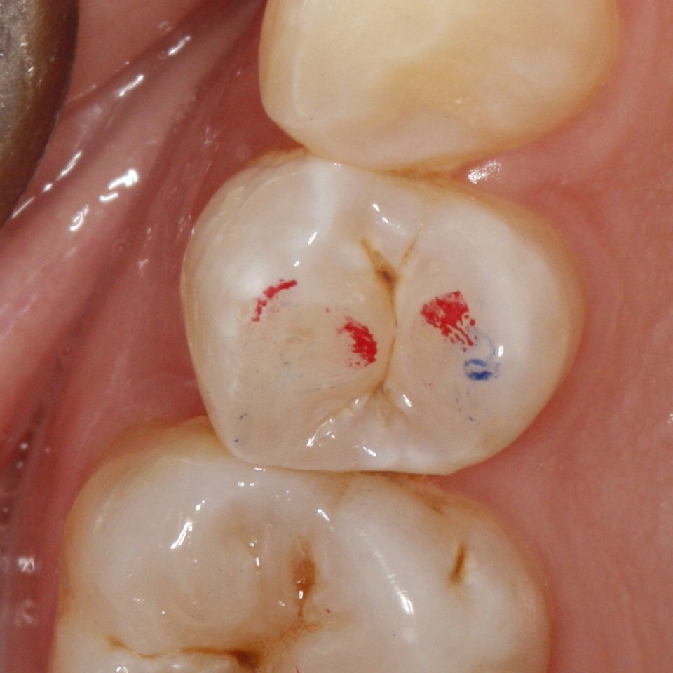 Teeth 3.jpg