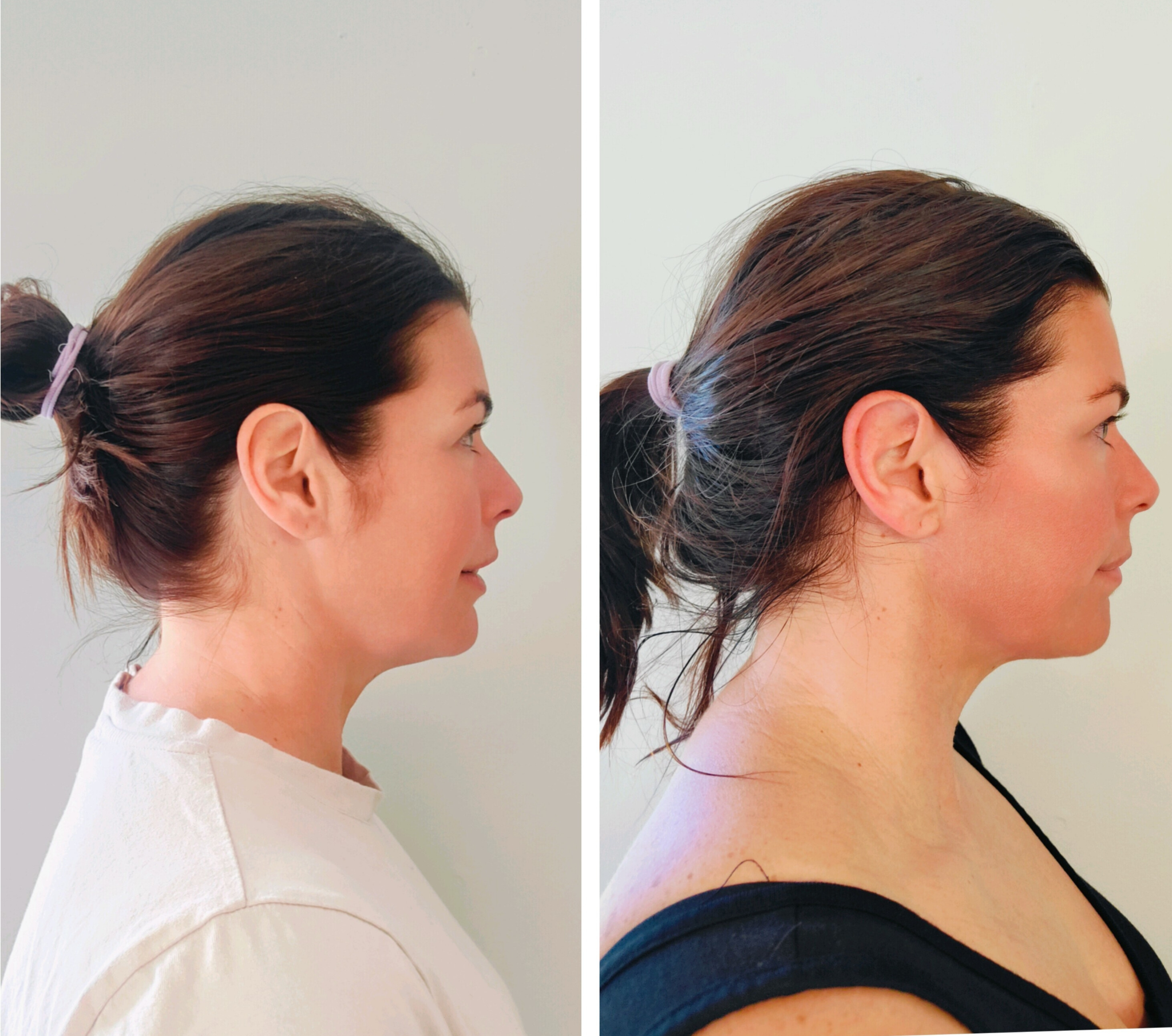 restore jaw line, face massage