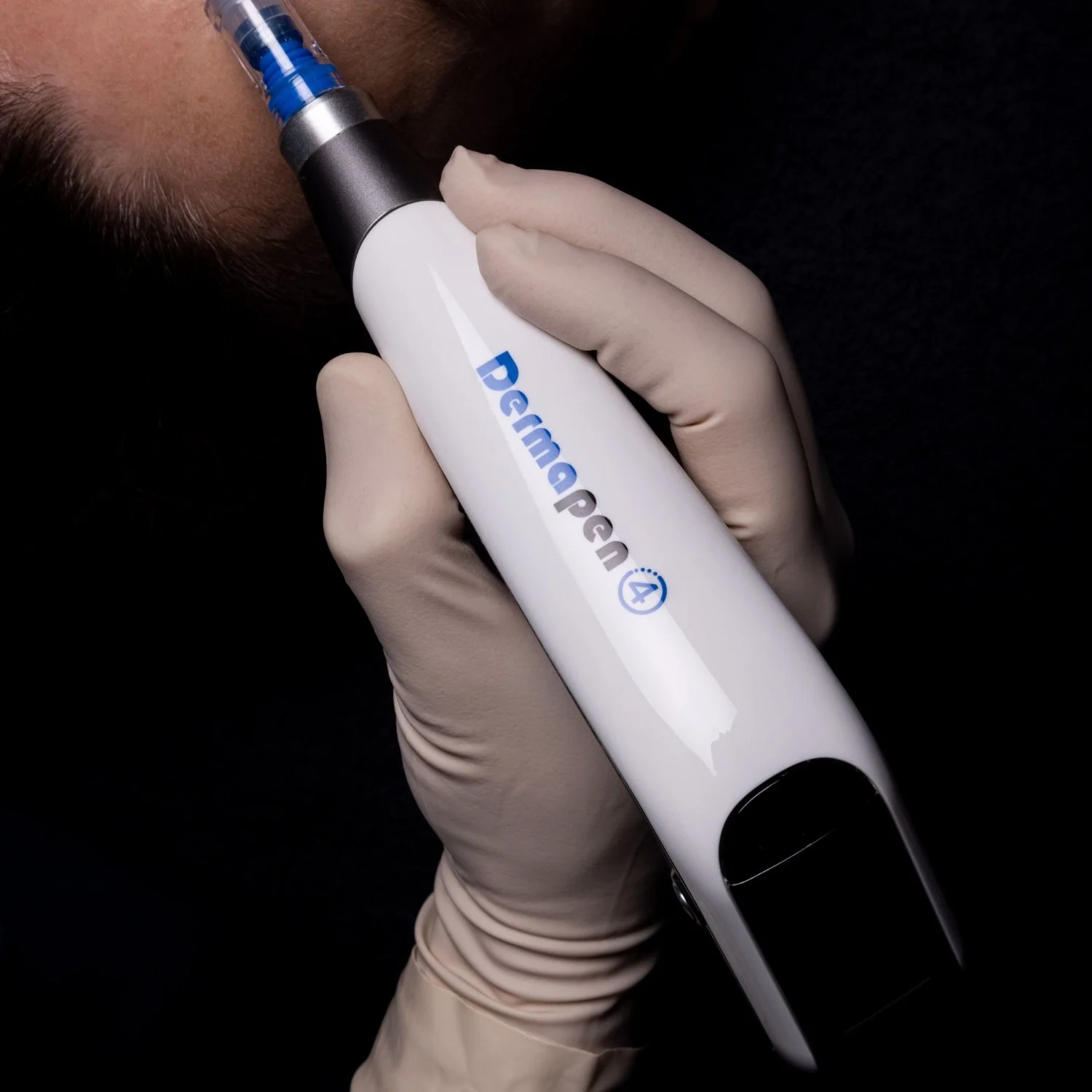 Collagen induction therapy — Dermapen4 microneedling