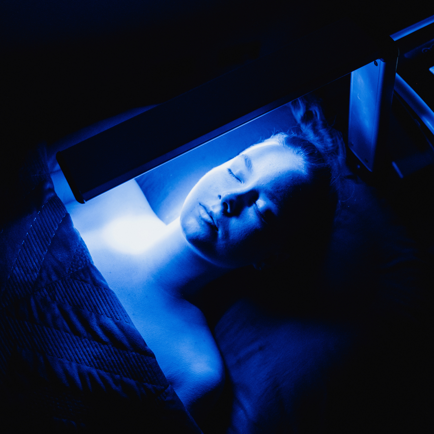 corneotherapy acne treatment Paddington Brisbane Plume Skin