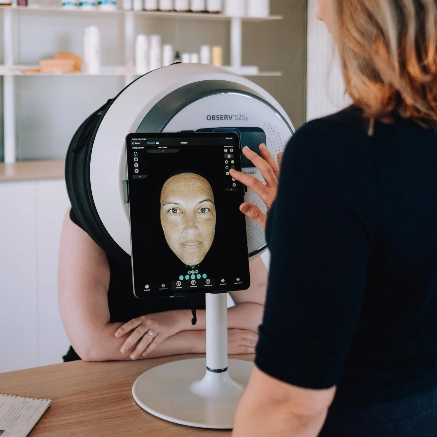 Observ 520x skin analysis showing sun damage and pigmentation beneath the surface of mature skin