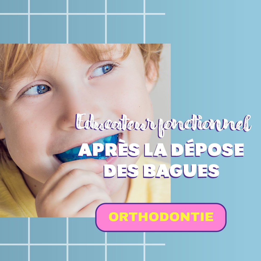 🦷 L’éducateur fonctionnel (TIPI) après la dépose des bagues