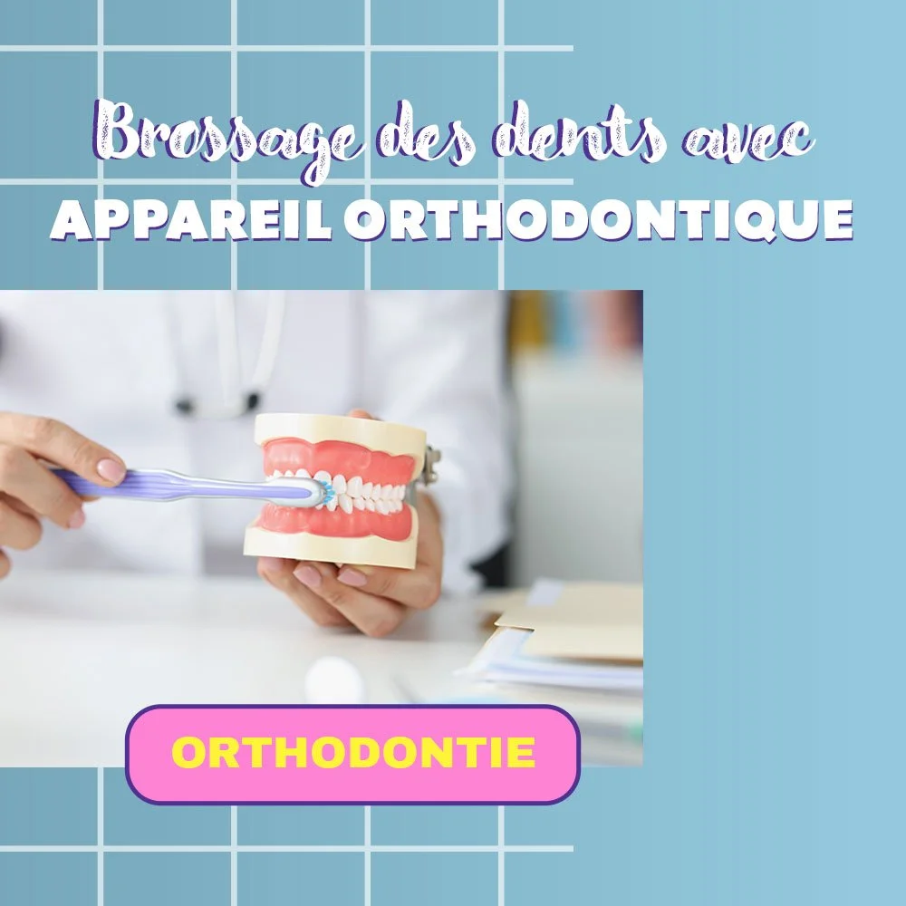 Brossage des dents avec appareil orthodontique : les gestes qui changent tout