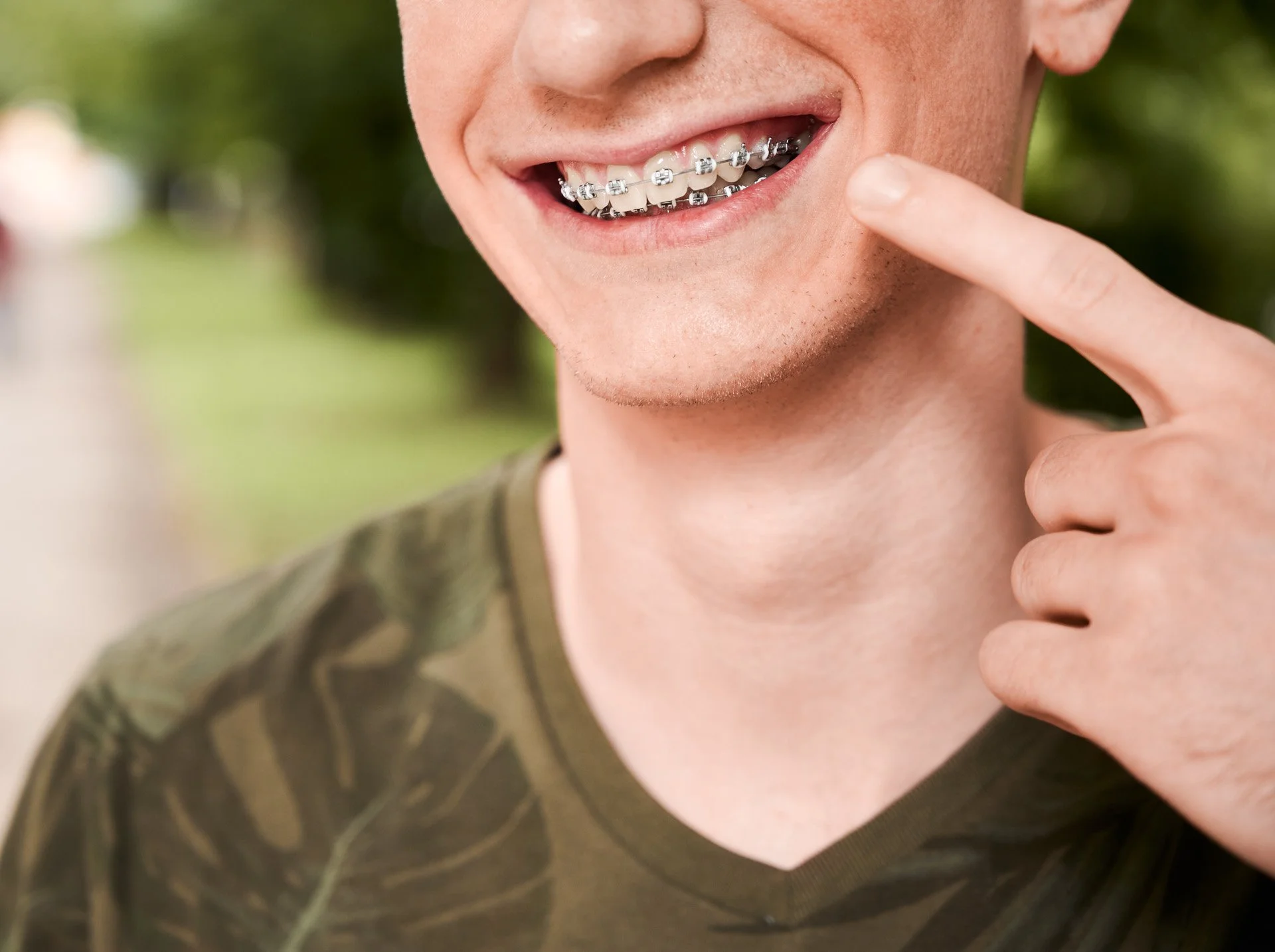 sourire avec brackets après brossage de dents bien réalisé