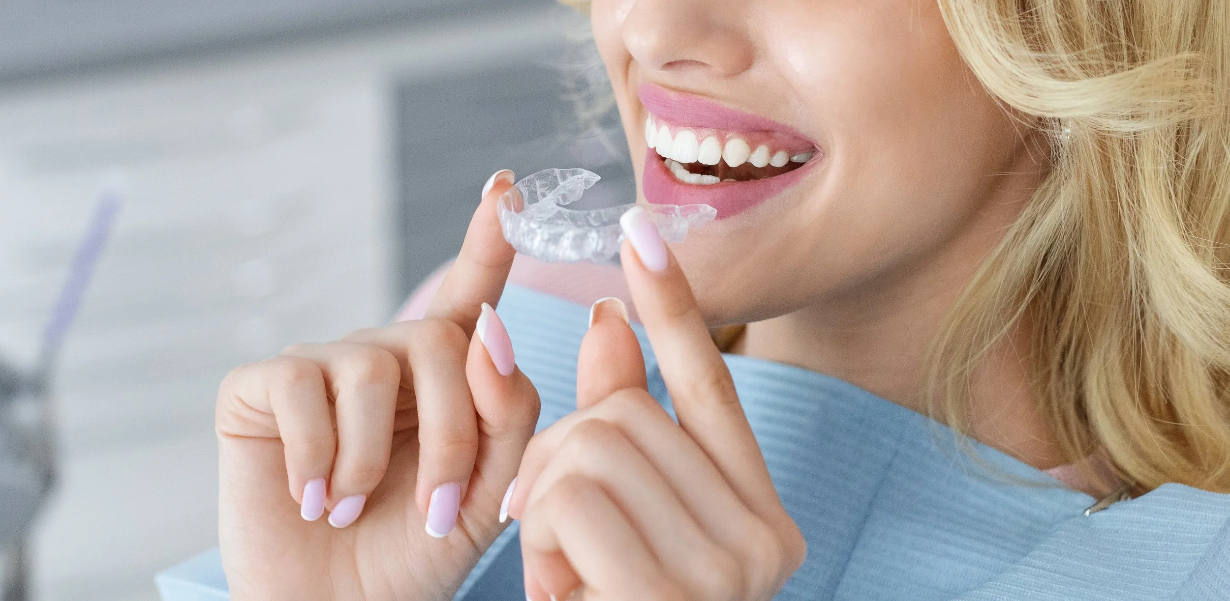 Gouttières transparentes pour traitement orthodontique chez l’adulte