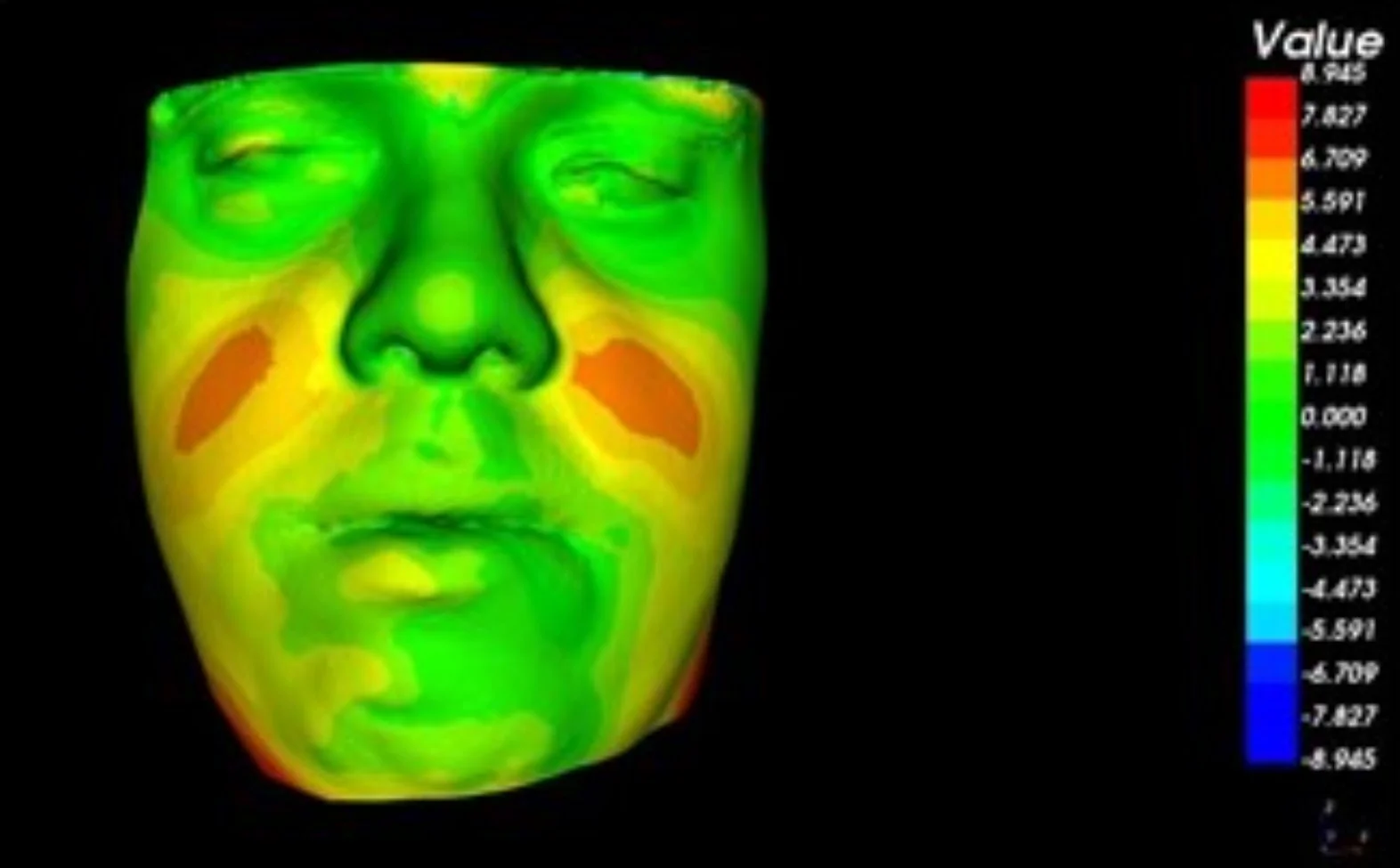 Graphique : Diapositive “Conclusion des études” présentant la référence Ain Shams Dental Journal et le titre de l’étude sur la précision de Dolphin 3D après chirurgie bimaxillaire — slide 4