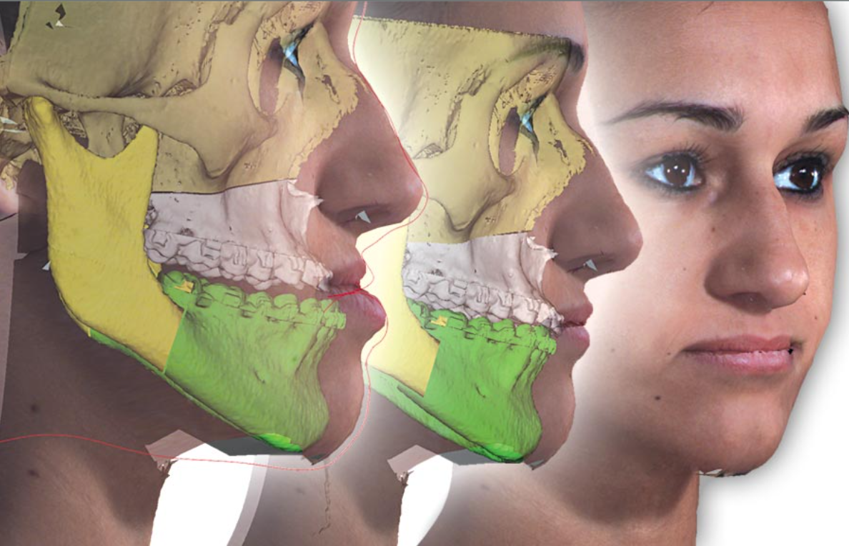 Graphique : Présentation du logiciel Dolphin Imaging — modules 3D-Surgery, simulation des déplacements et des tissus mous, planification segmentée, export gouttières — slide 5