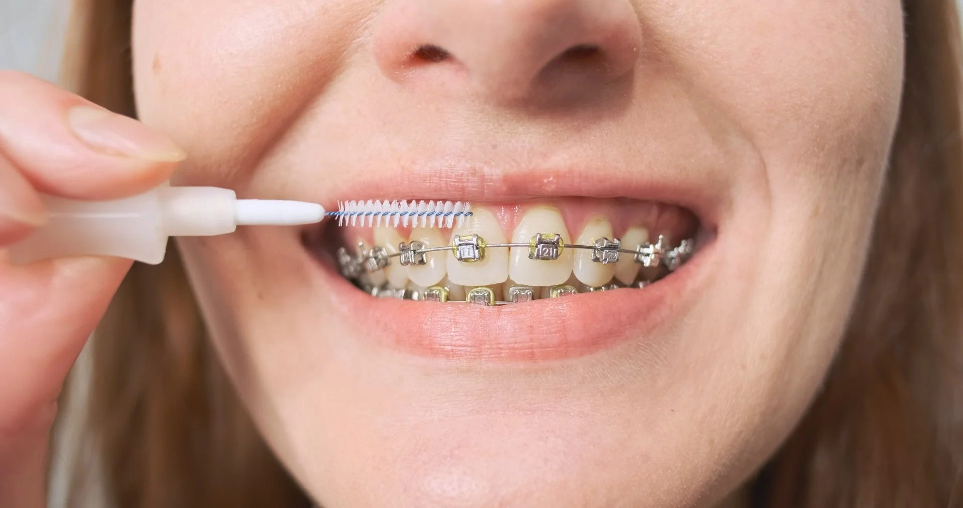 Brossage de dents avec appareil fixe