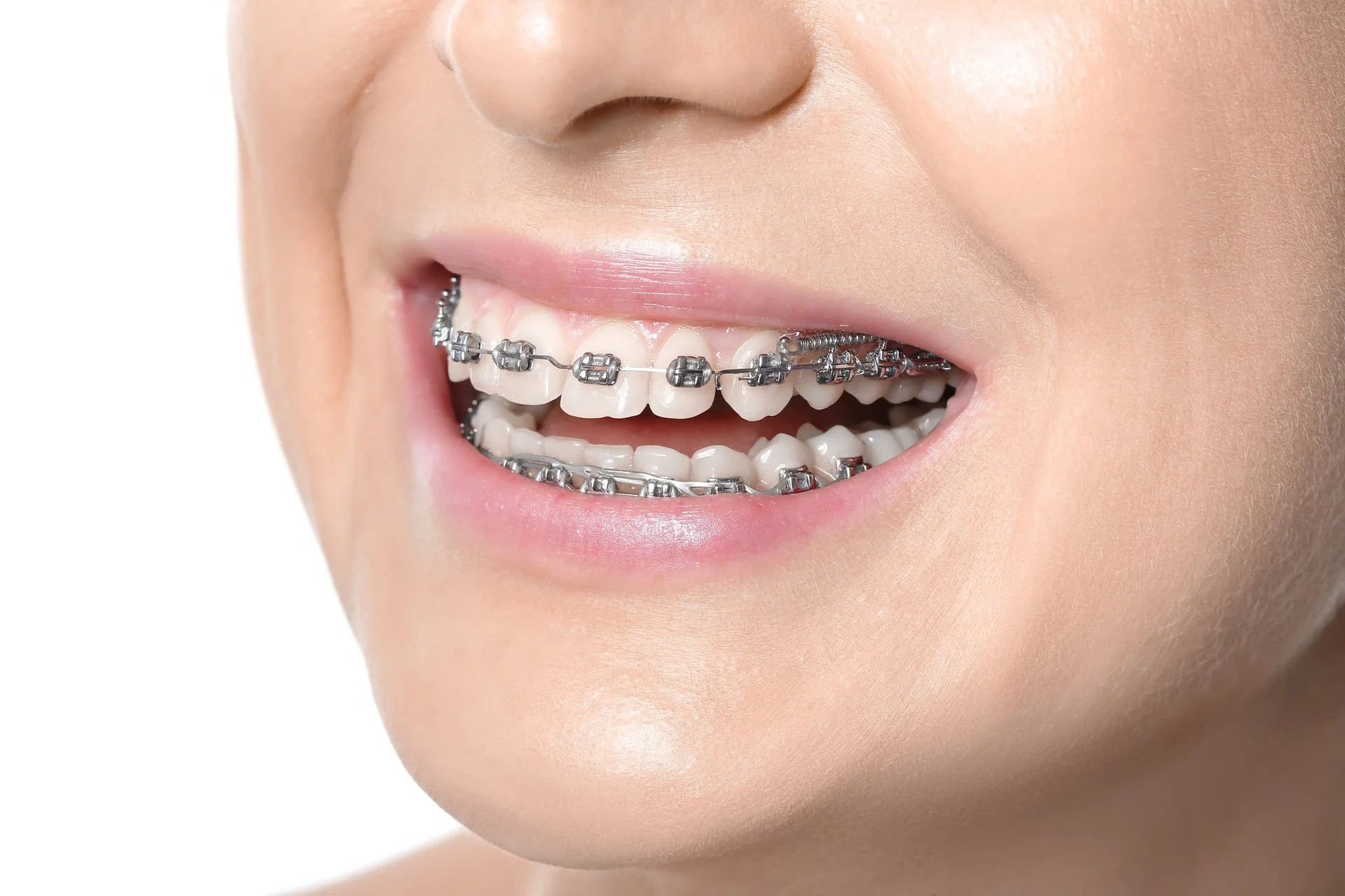 orthodontiste traitant patient avec cas complexe