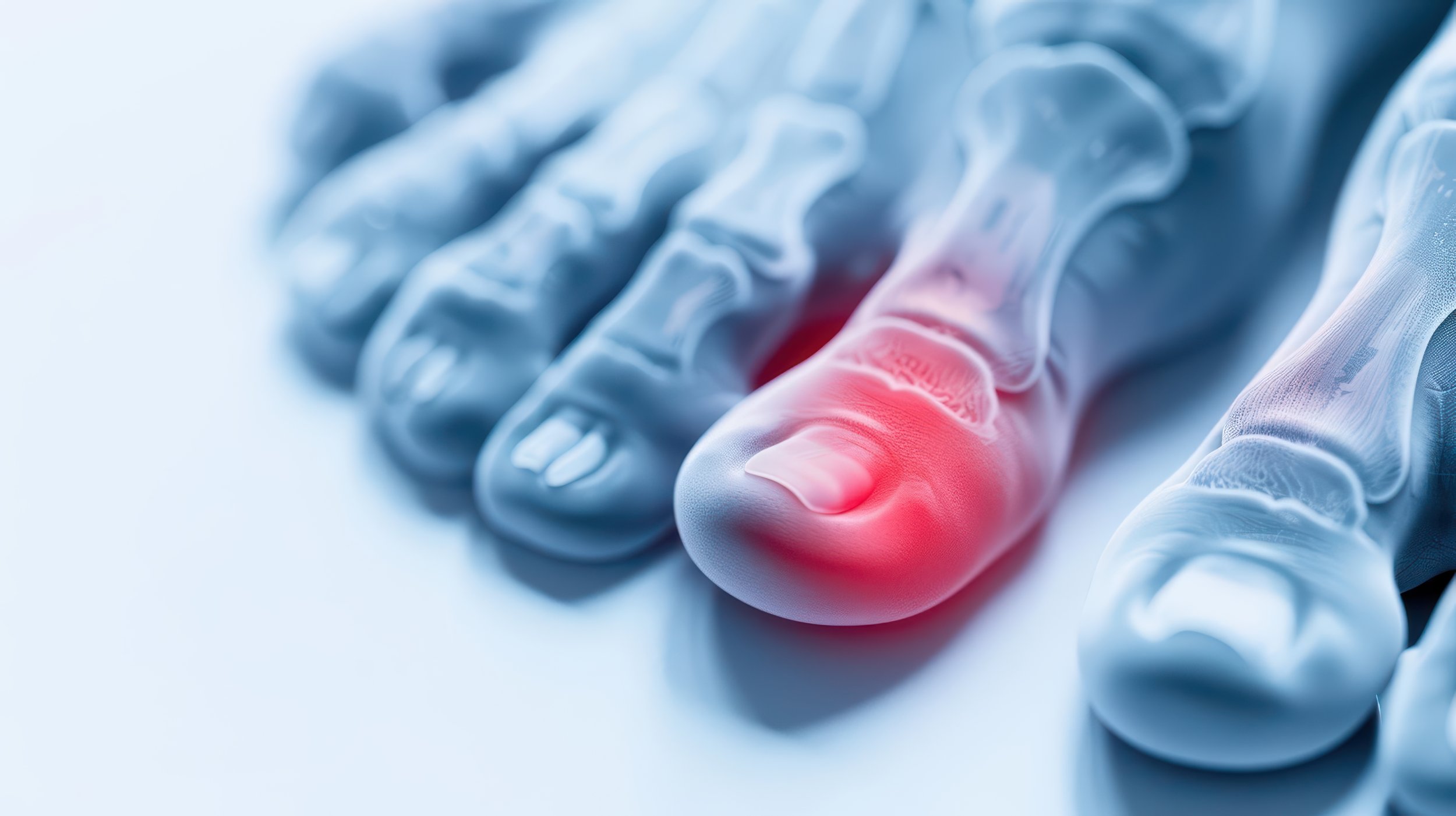 What Causes Ingrown Toenails?