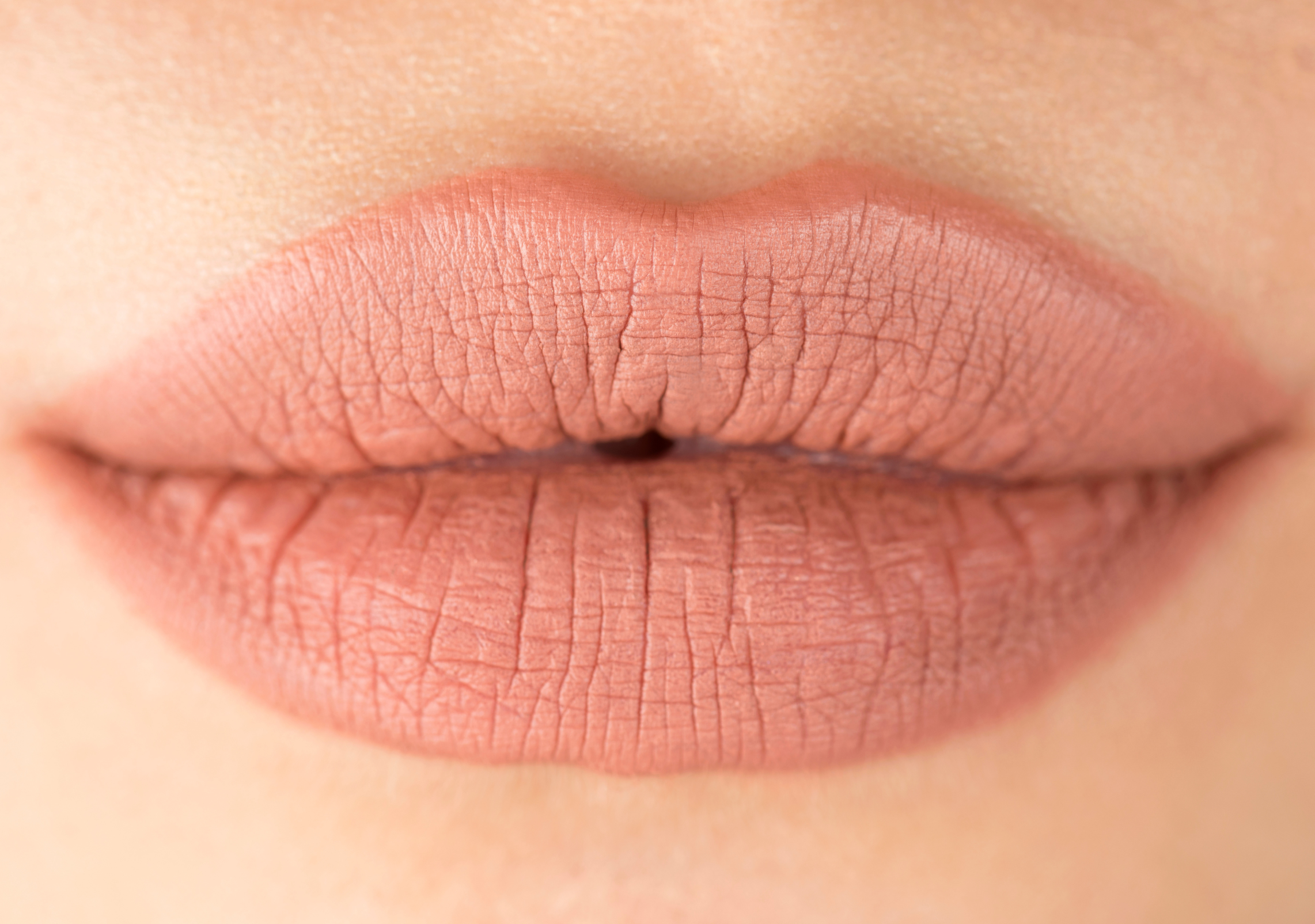 CHAPTER SIXTY-NINE: The Truth About Lip Flips — A Subtle Alternative to Lip Filler
