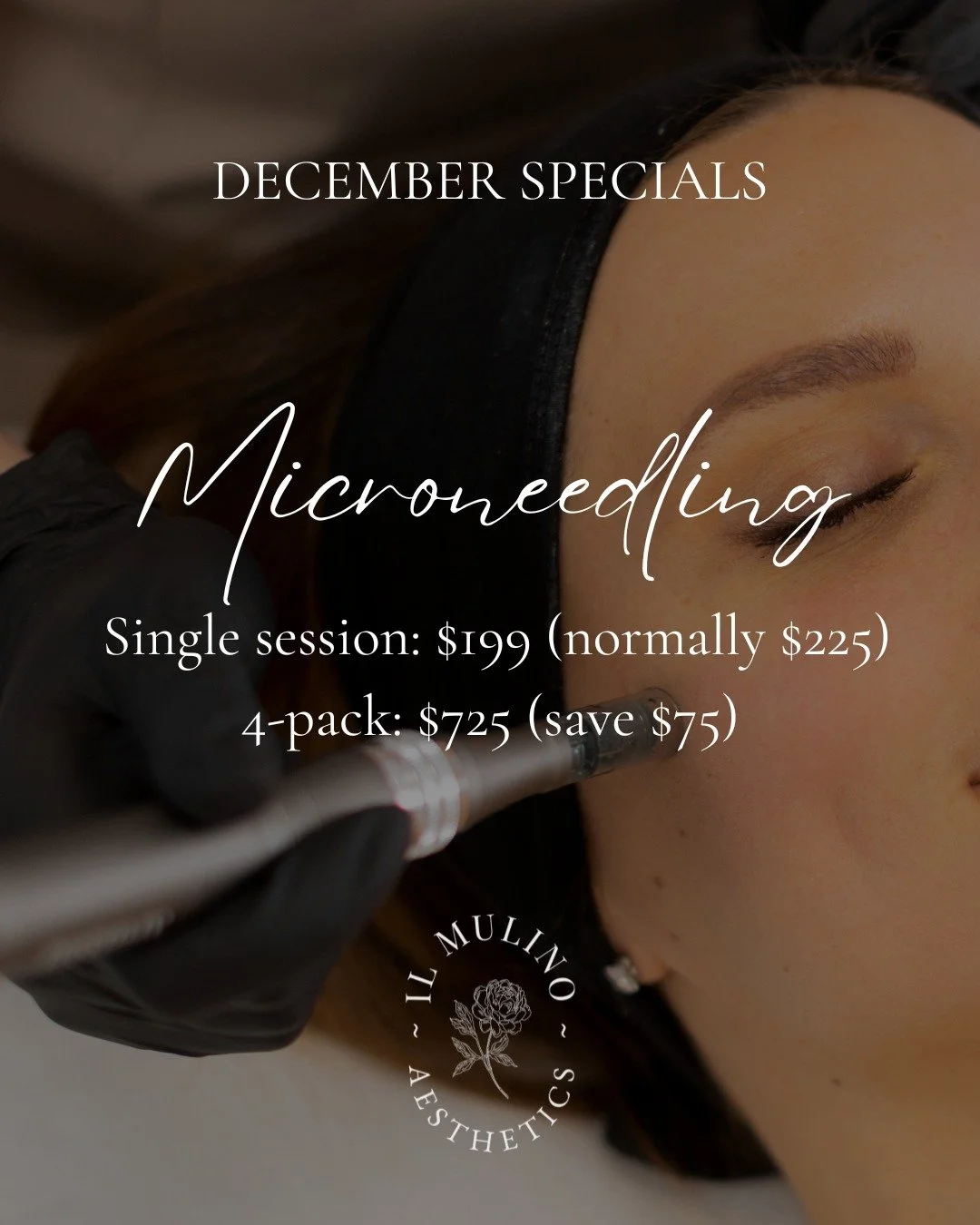 ✨Glow into the new year! Microneedling single session now $199 (normally $225) or 4-pack for $725 (save $75).

Click the link in our bio, or call/text (716) 954-3122 to book your session!

#IlMulinoAesthetics#SkinRejuvenation #CollagenBoost #Micronee